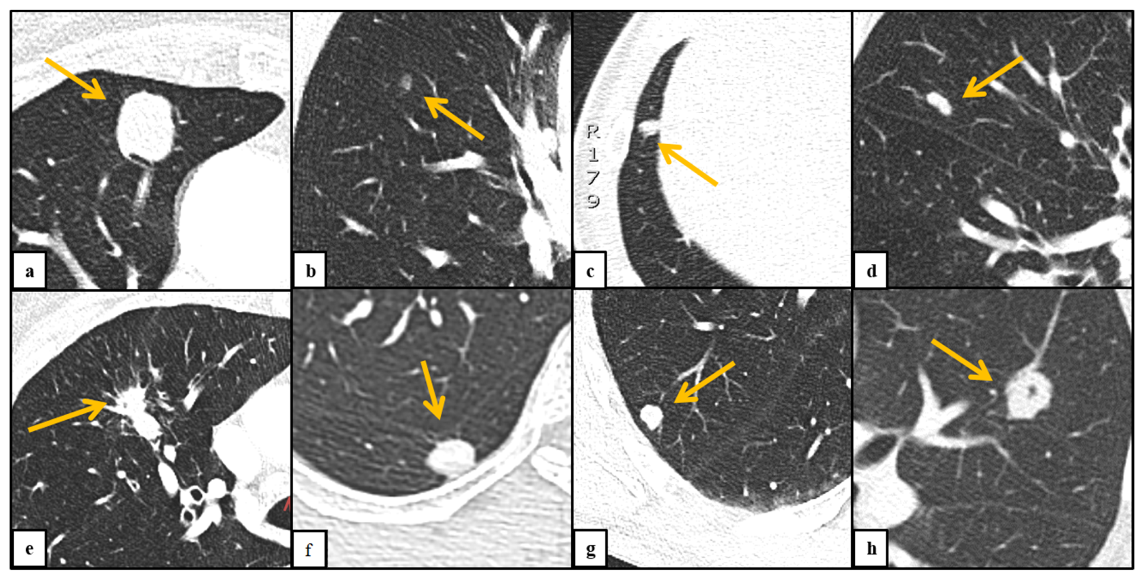 Diagnostics 11 00837 g001