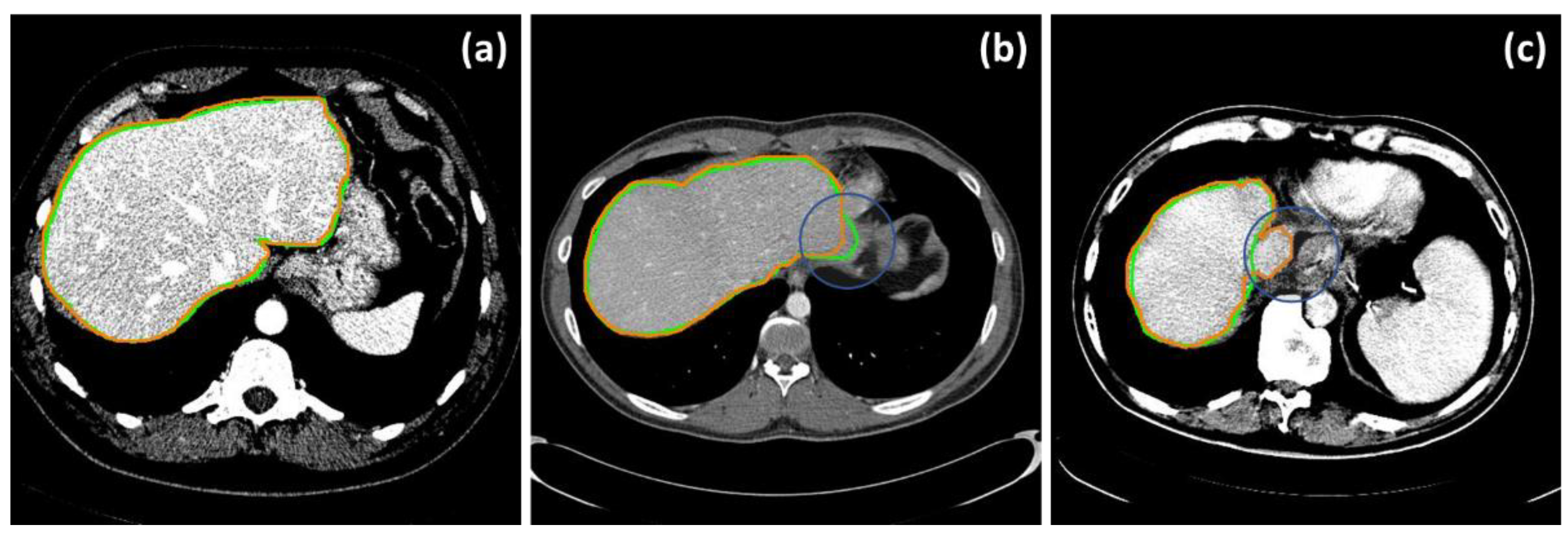 Diagnostics 11 00852 g004