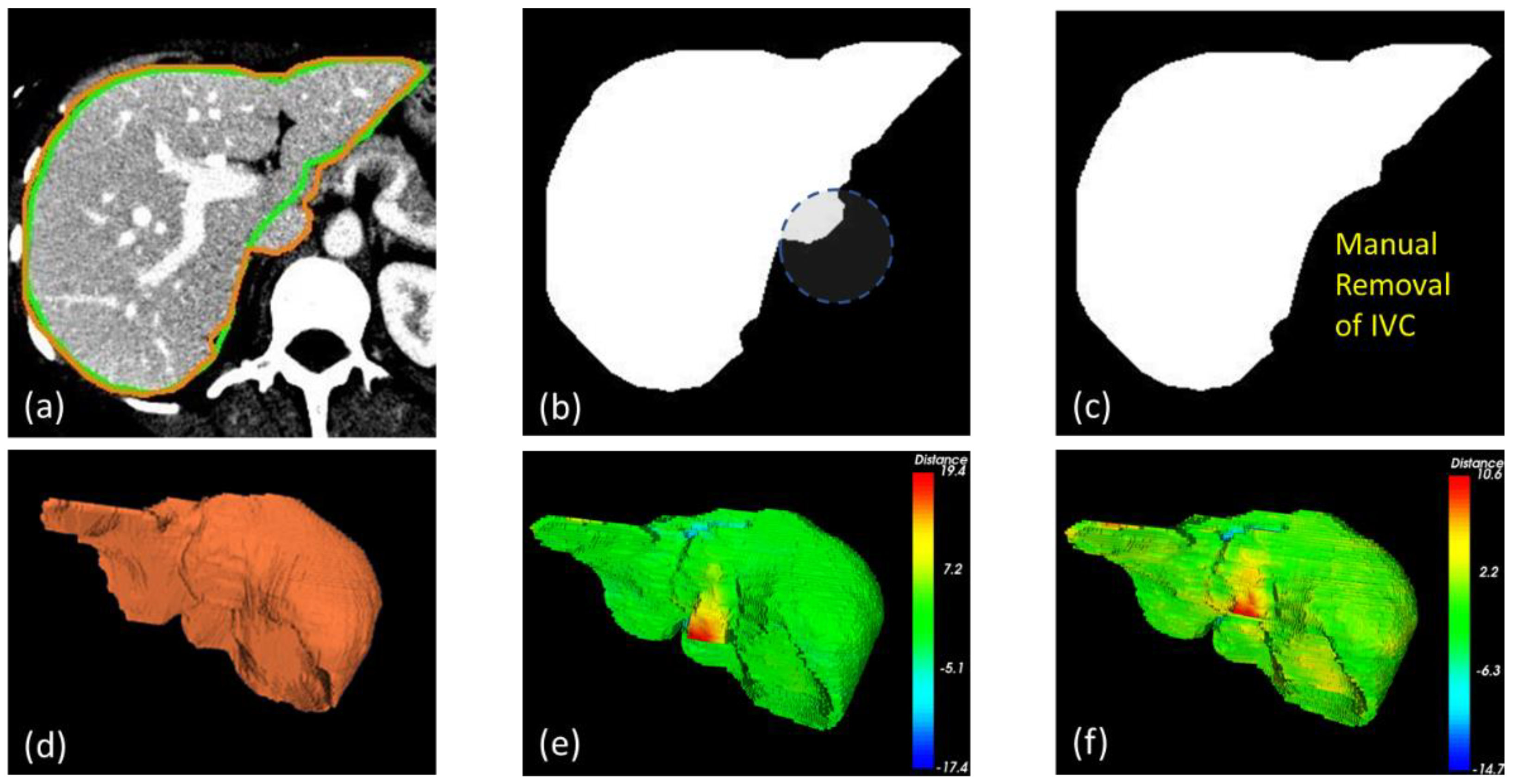 Diagnostics 11 00852 g005