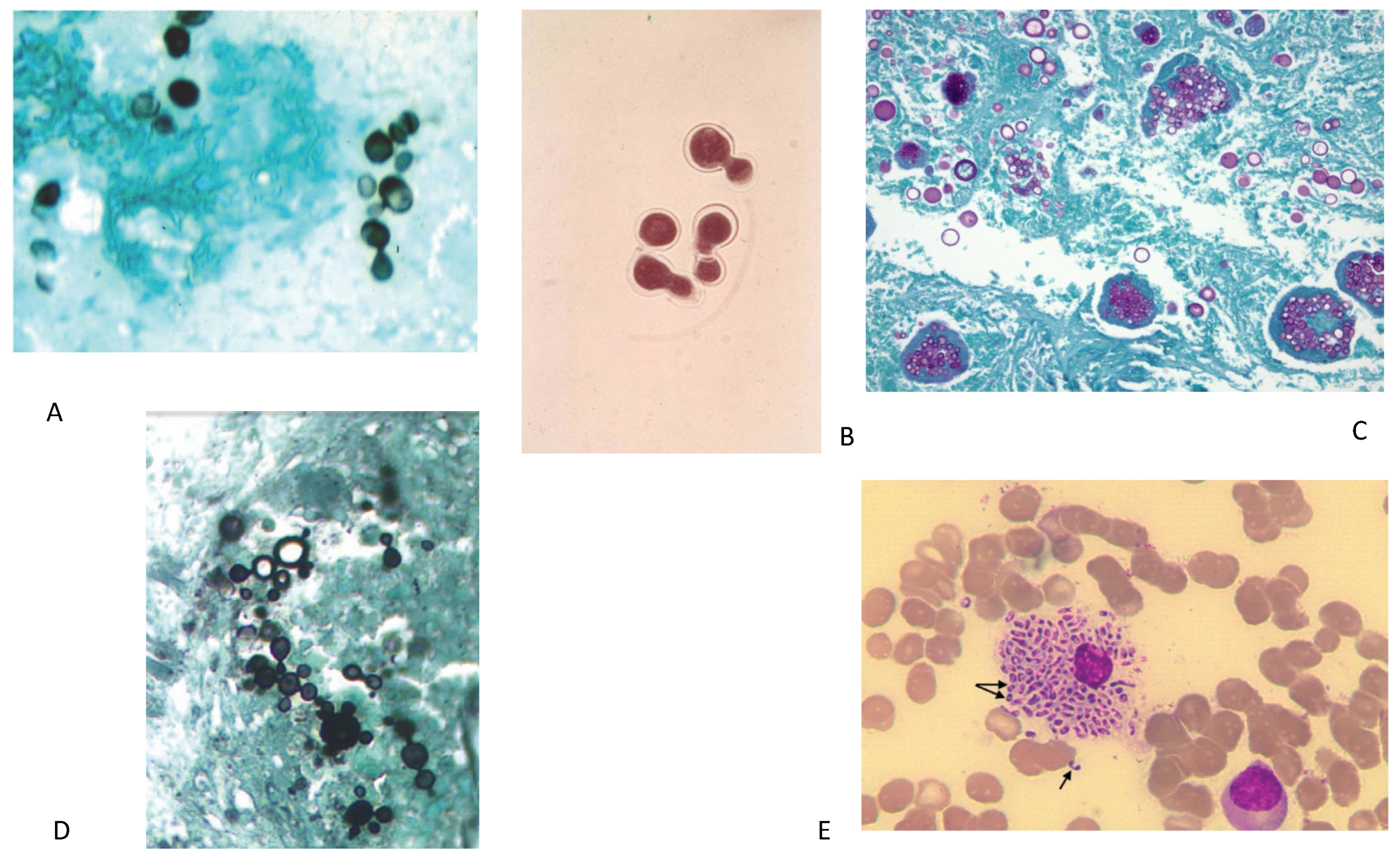 Diagnostics | Free Full-Text | Diagnosis of Pulmonary Infections ...