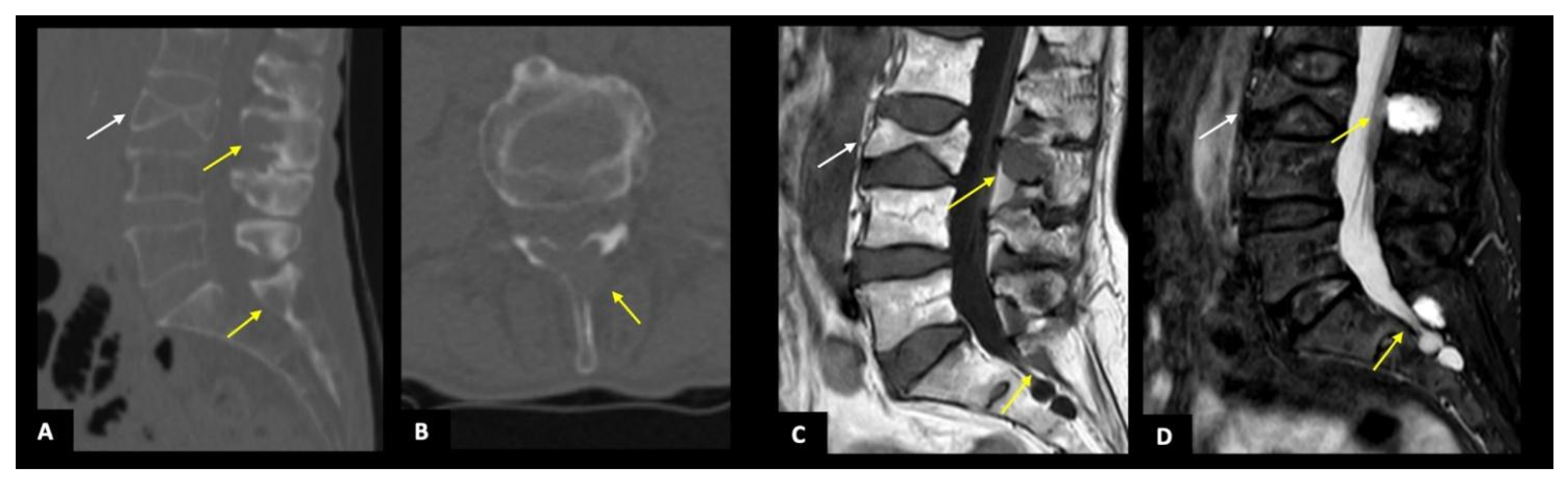 Diagnostics 11 00857 g002 Diagnostics 11 00857 g002
