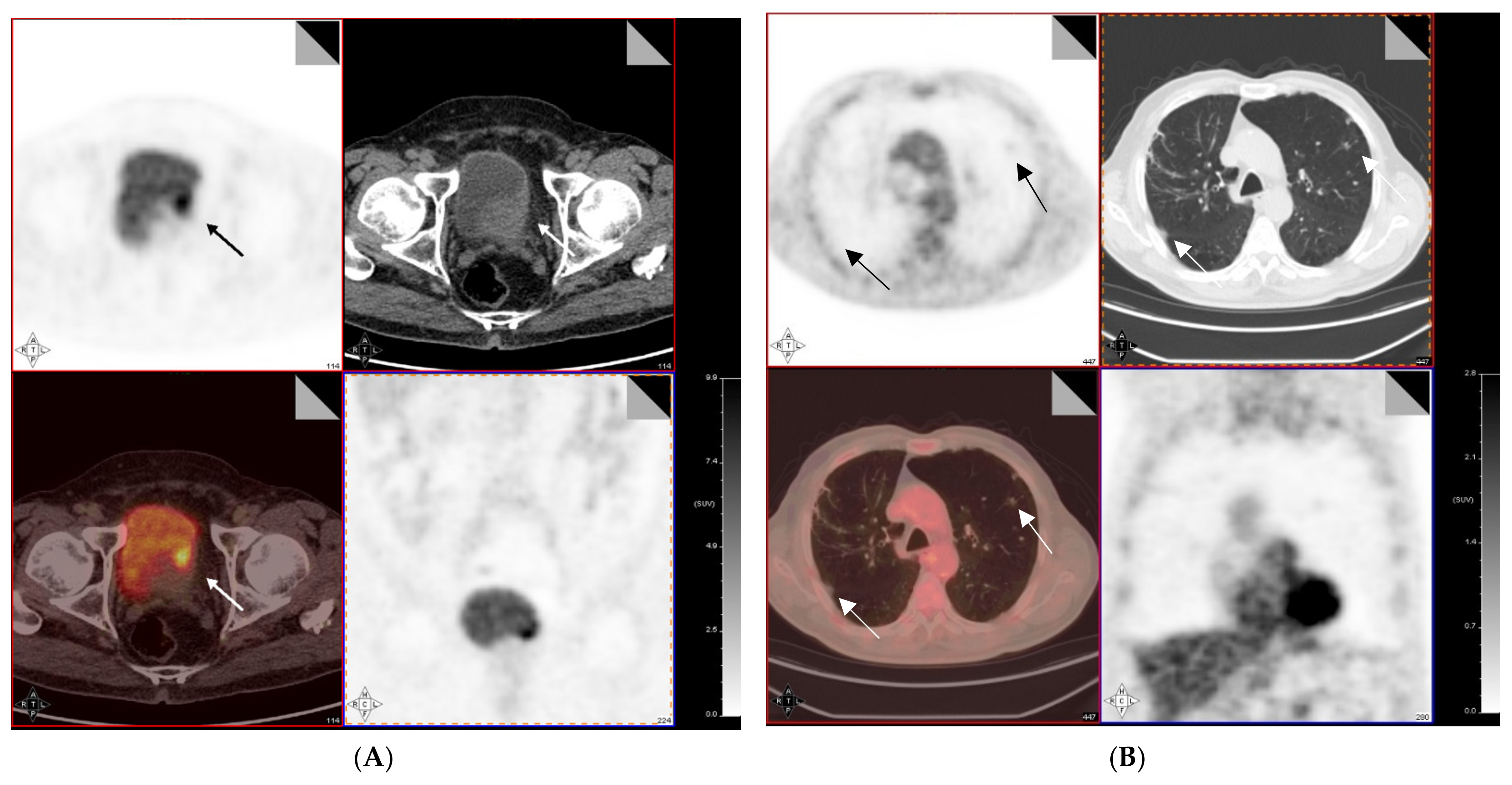 Diagnostics 11 00863 g001 Diagnostics 11 00863 g001