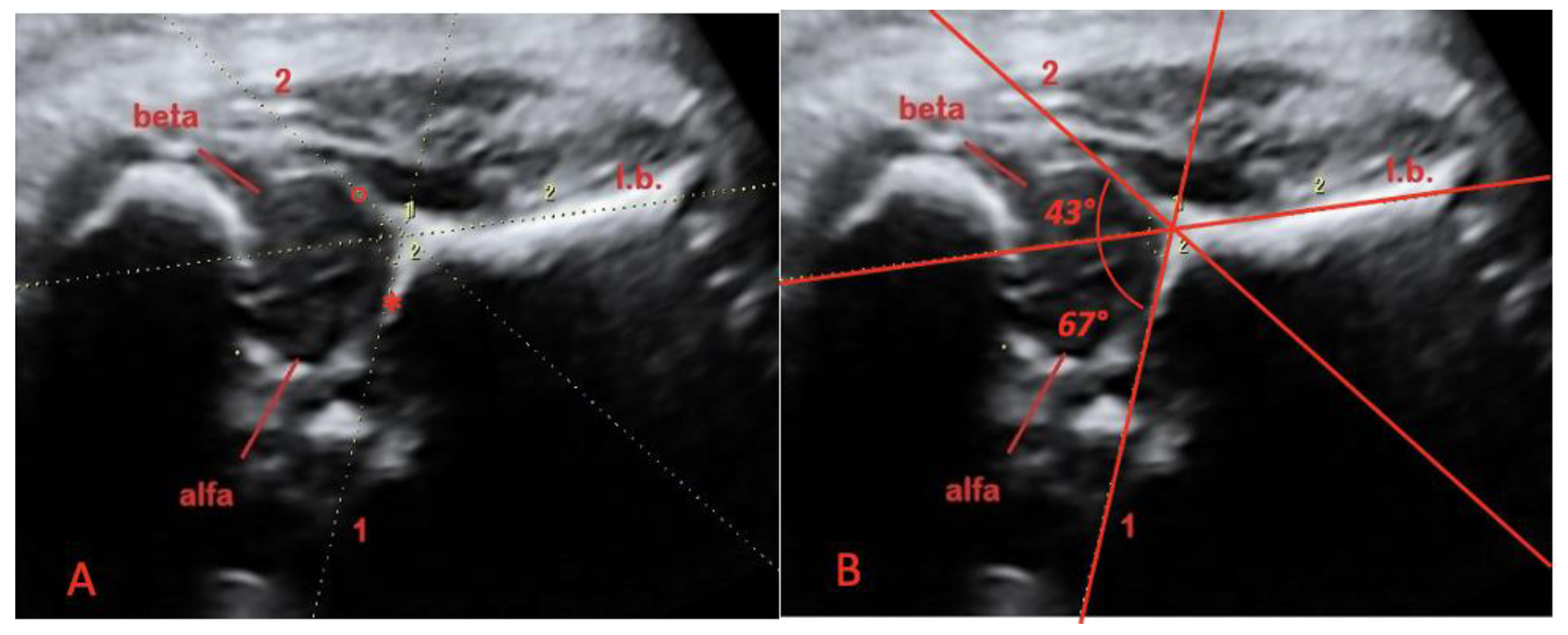Diagnostics 11 00868 g001