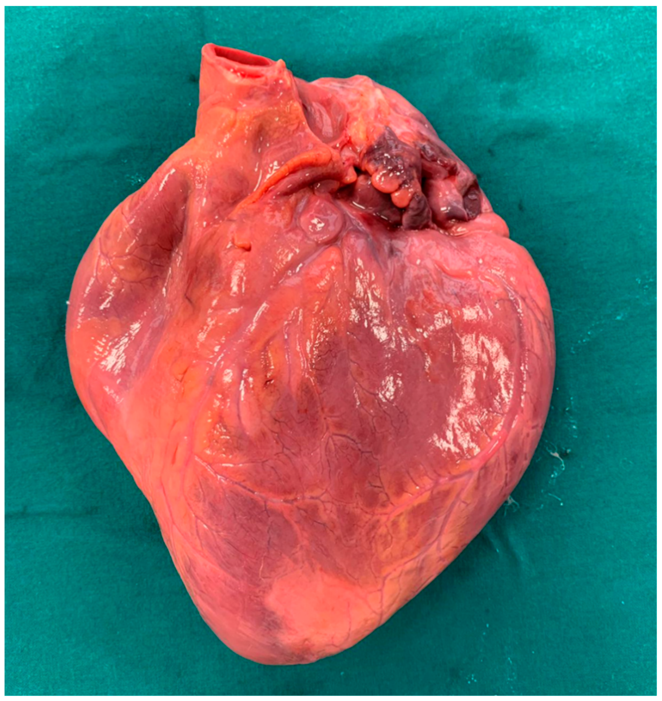 Diagnostics 11 00886 g001