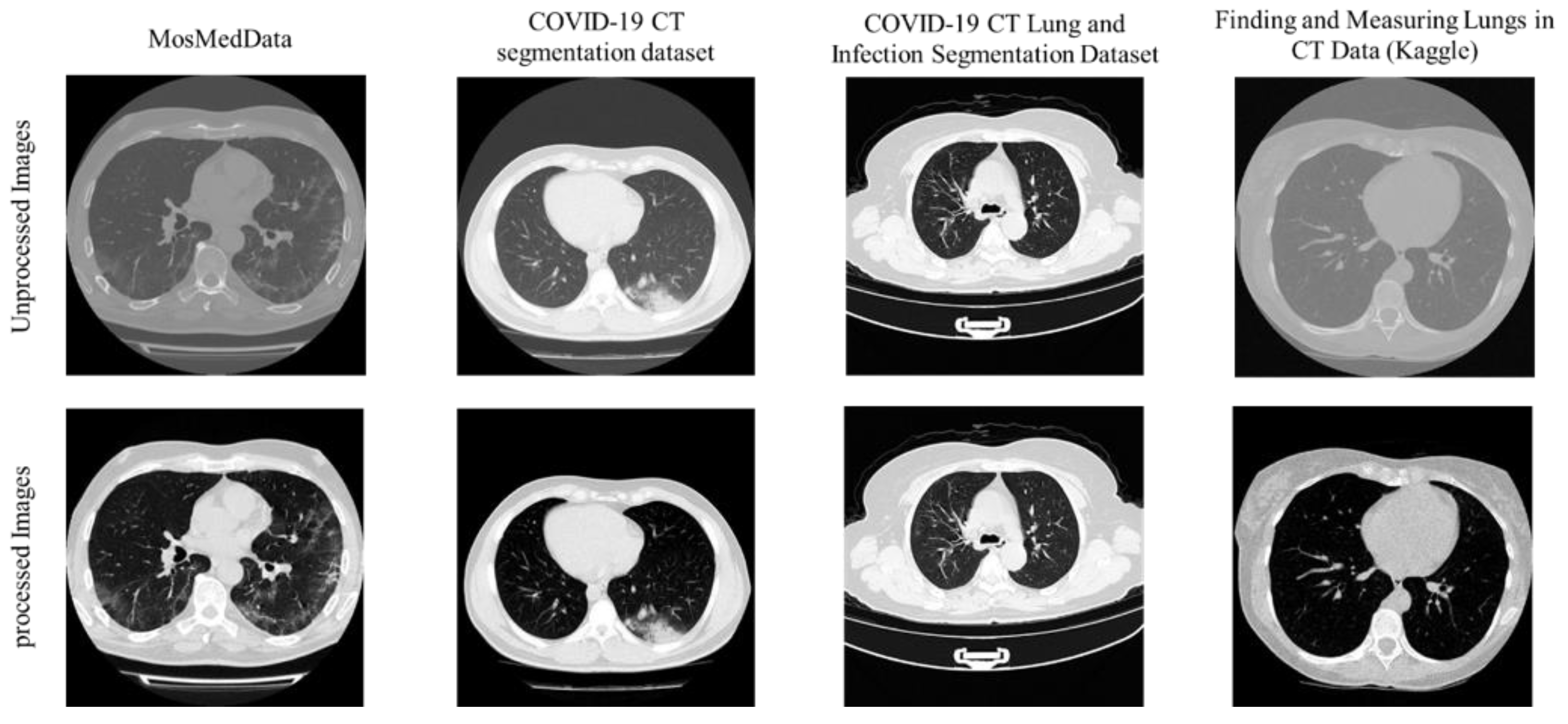 Diagnostics Free FullText Detection and Severity Classification of