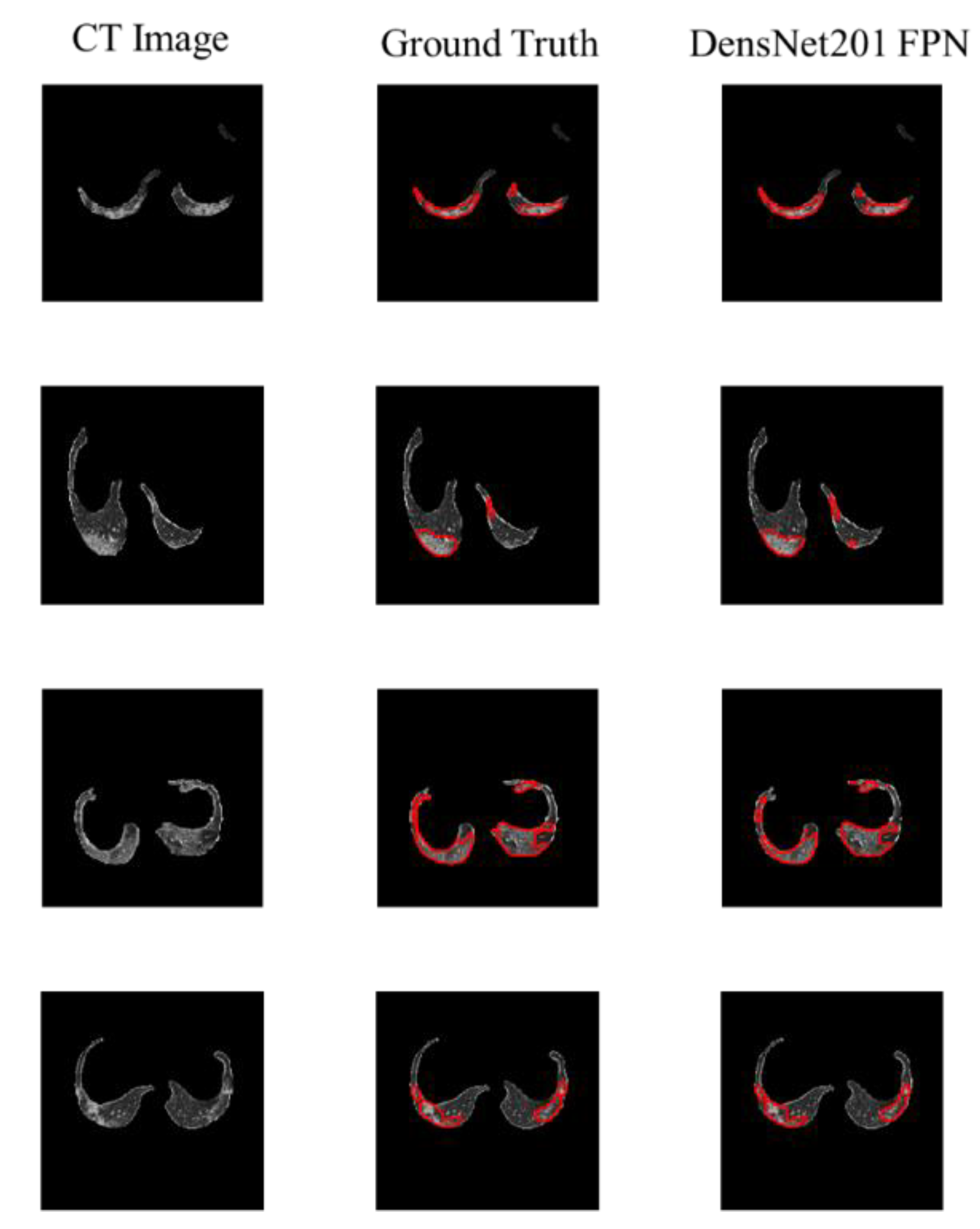 Diagnostics 11 00893 g006 Diagnostics 11 00893 g006