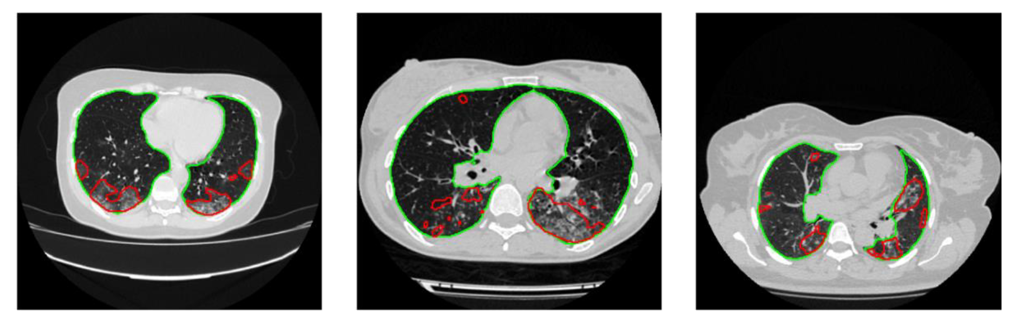 Diagnostics 11 00893 g007 Diagnostics 11 00893 g007