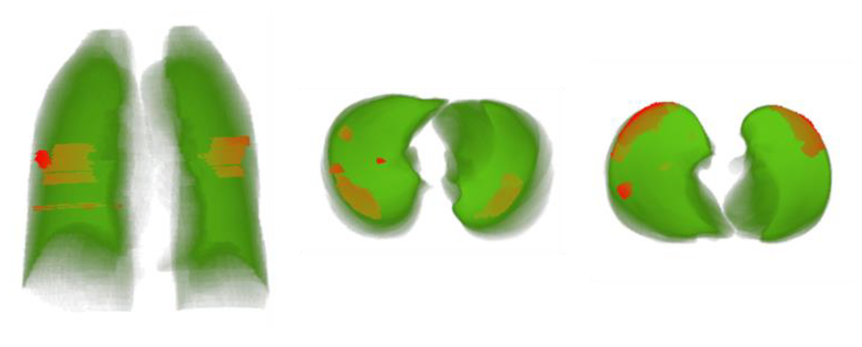 Diagnostics 11 00893 g009 Diagnostics 11 00893 g009