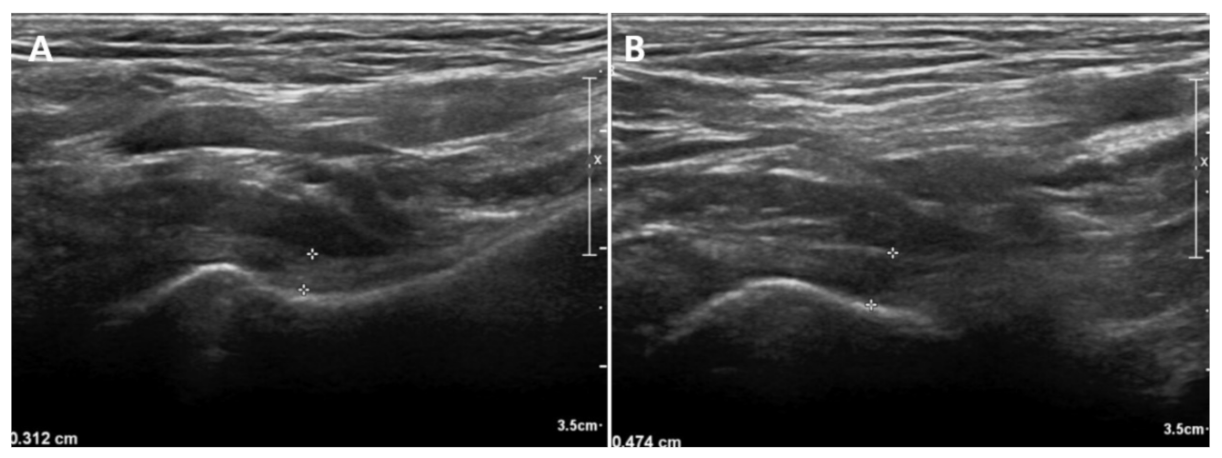 Diagnostics 11 00898 g003