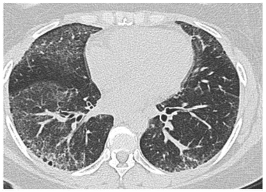 Diagnostics 11 00911 g001 Diagnostics 11 00911 g001