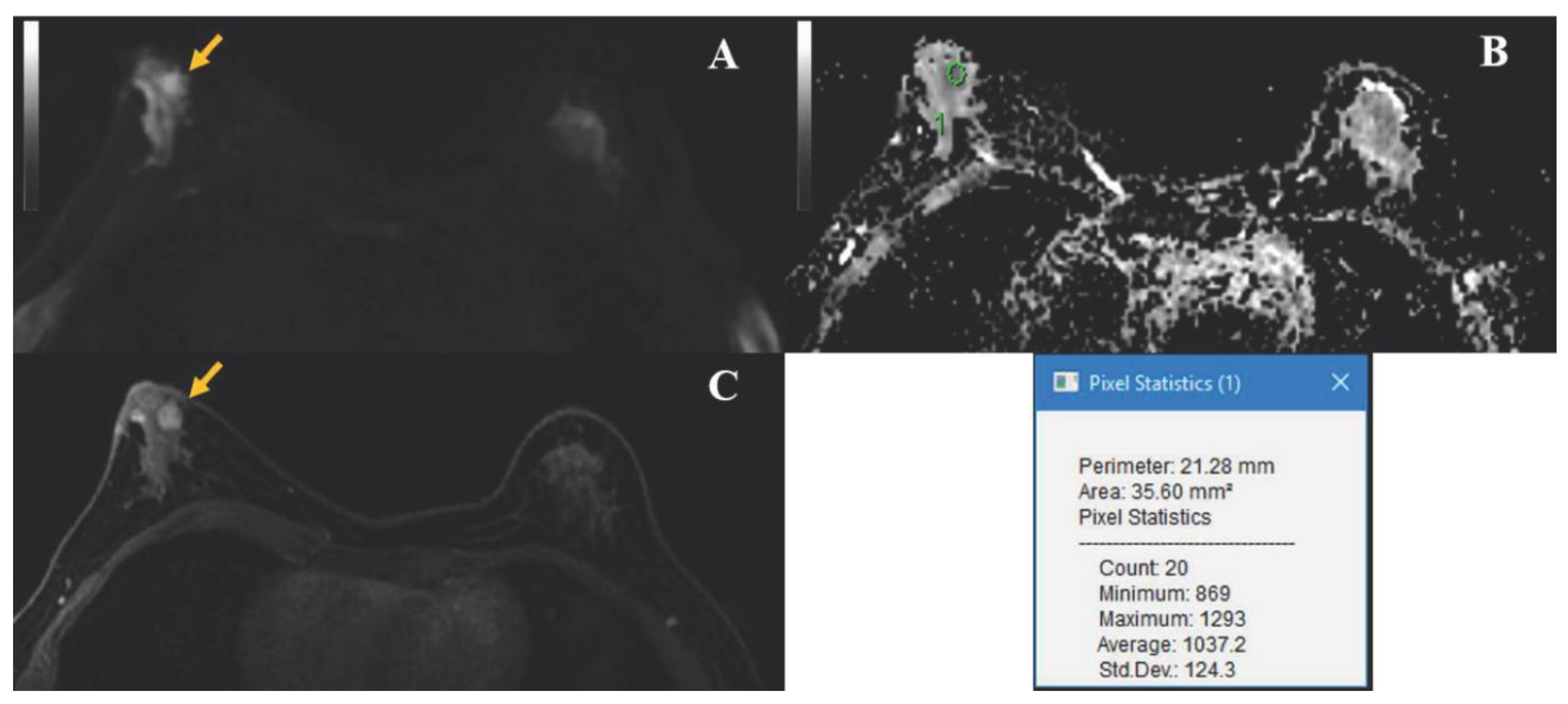 Diagnostics 11 00919 g004 Diagnostics 11 00919 g004