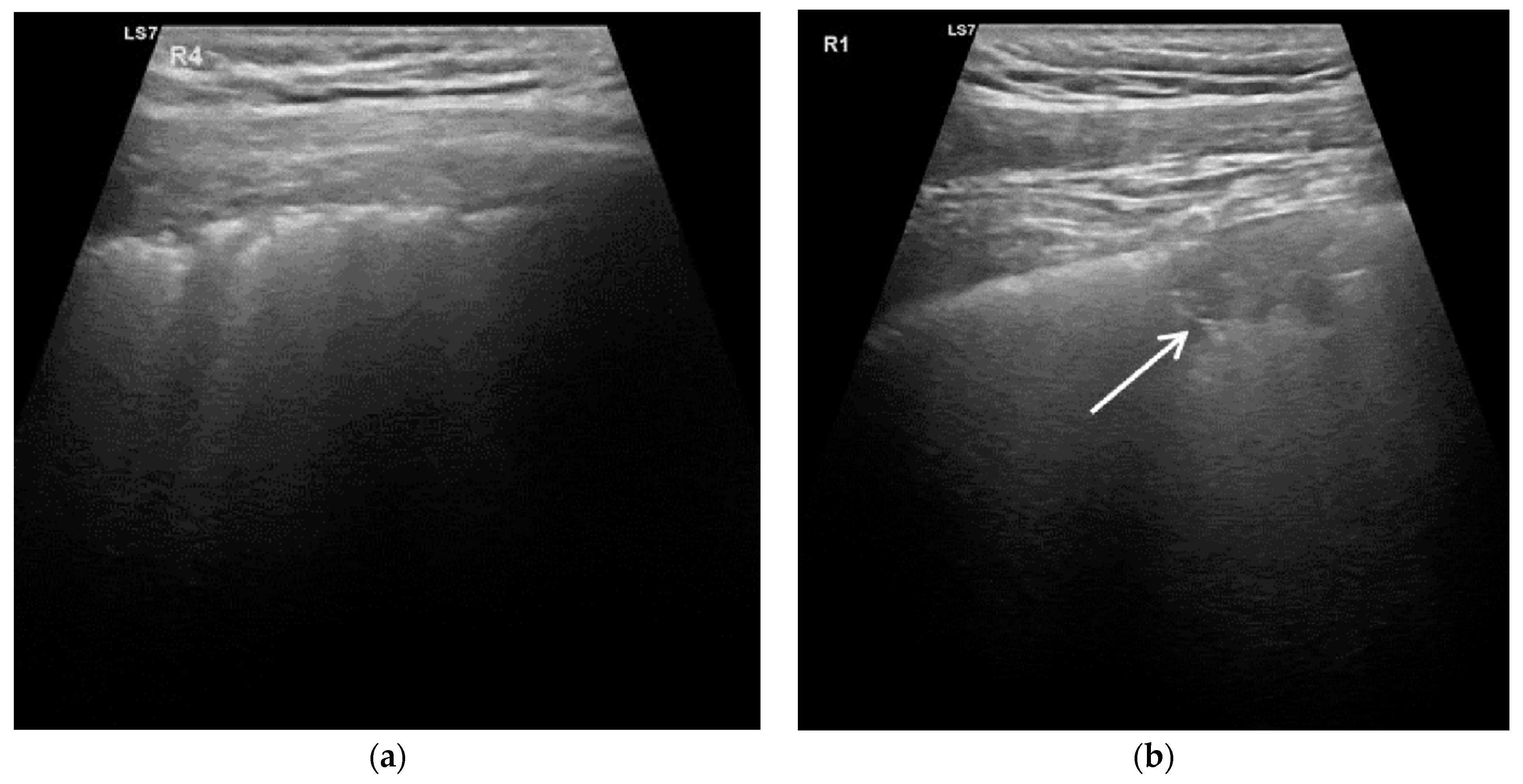 Diagnostics 11 00921 g002