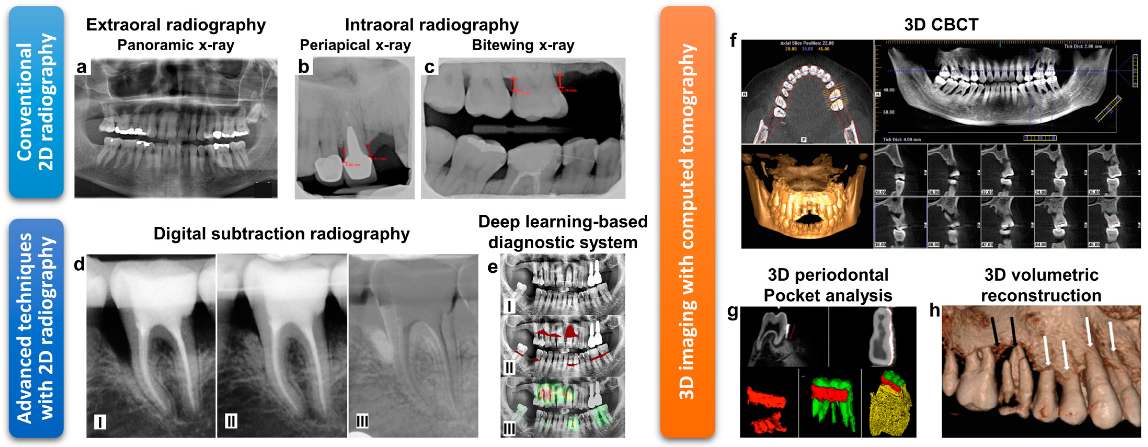 Diagnostics Free Full Text The Chairside Periodontal Diagnostic Toolkit Past Present And Future Html