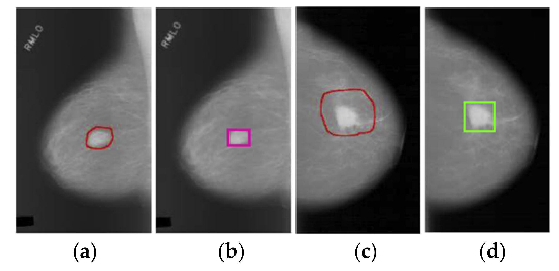 Diagnostics 11 00933 g002 Diagnostics 11 00933 g002