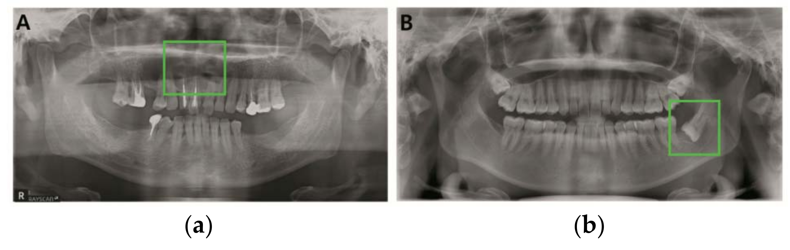 Diagnostics 11 00933 g003 Diagnostics 11 00933 g003