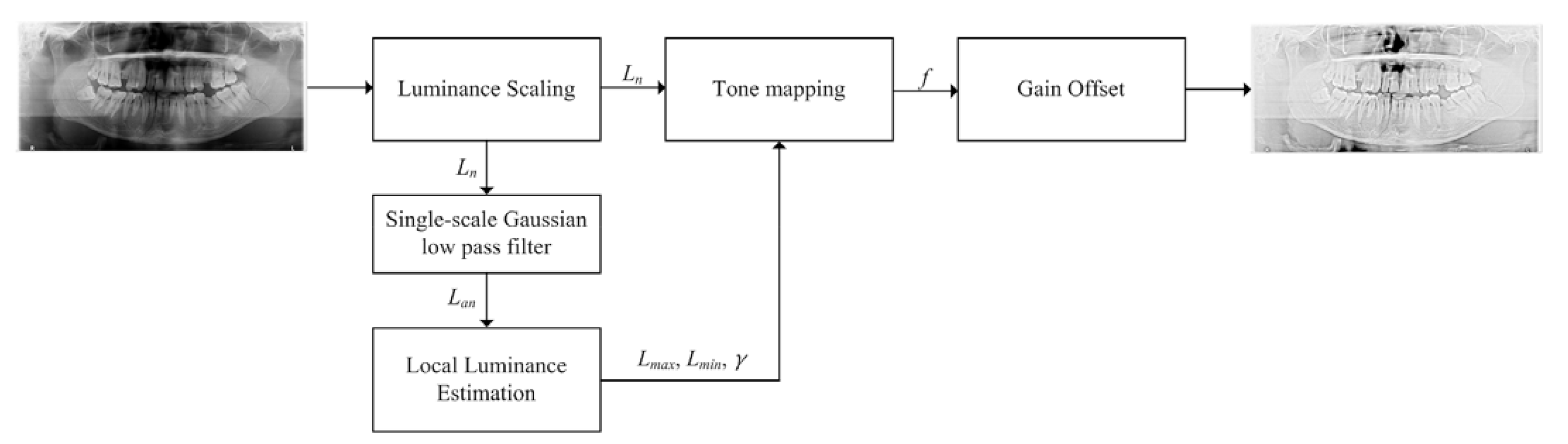 Diagnostics 11 00933 g009 Diagnostics 11 00933 g009