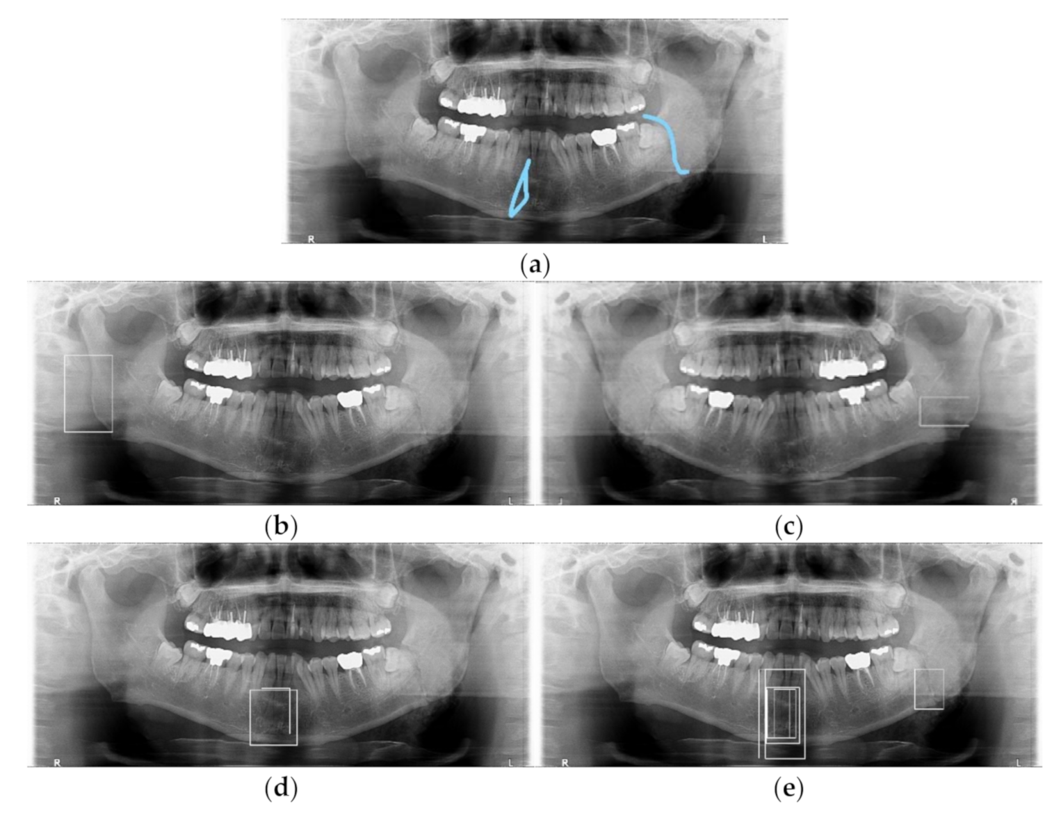 Diagnostics 11 00933 g011 Diagnostics 11 00933 g011