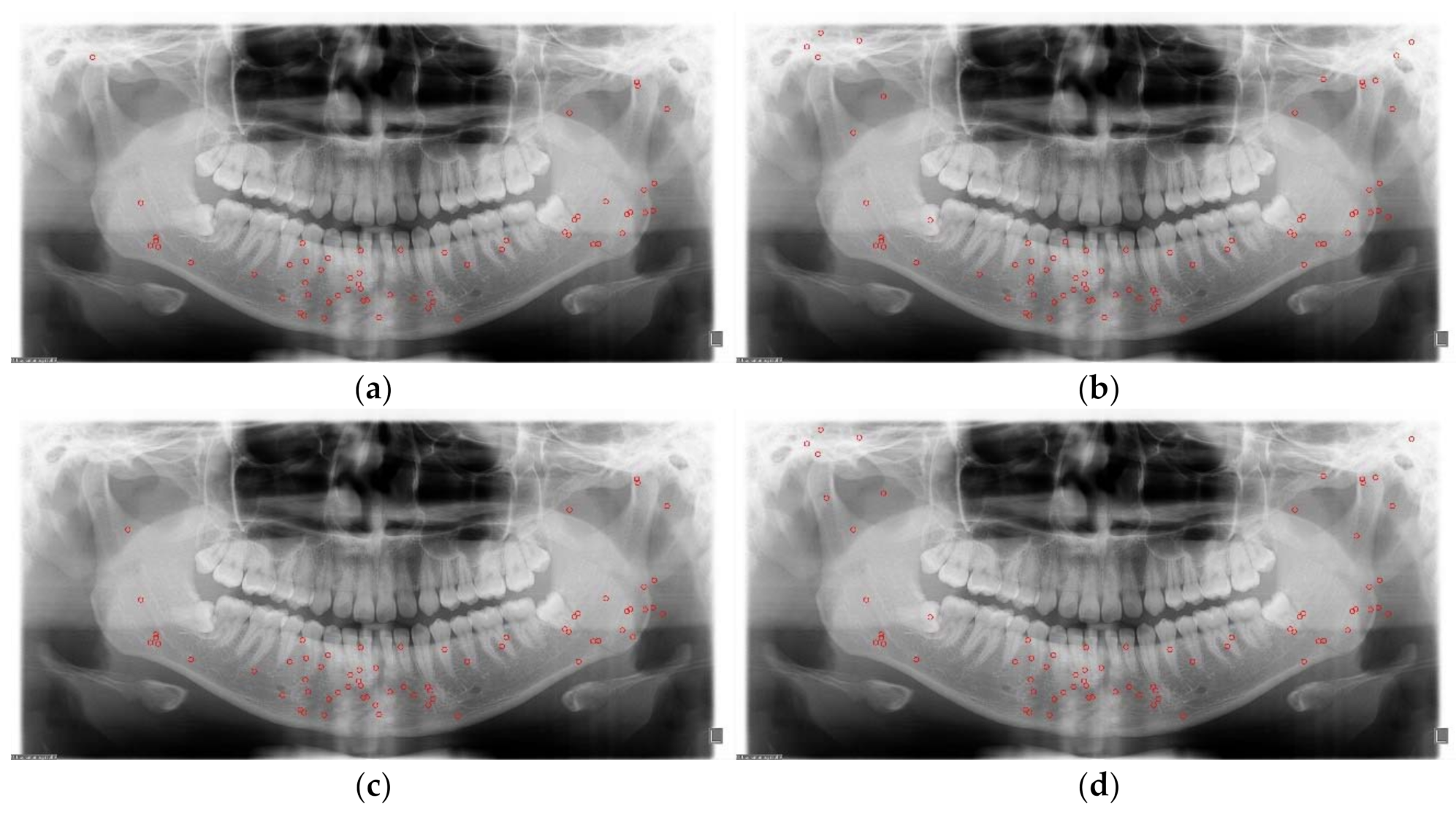 Diagnostics 11 00933 g013 Diagnostics 11 00933 g013