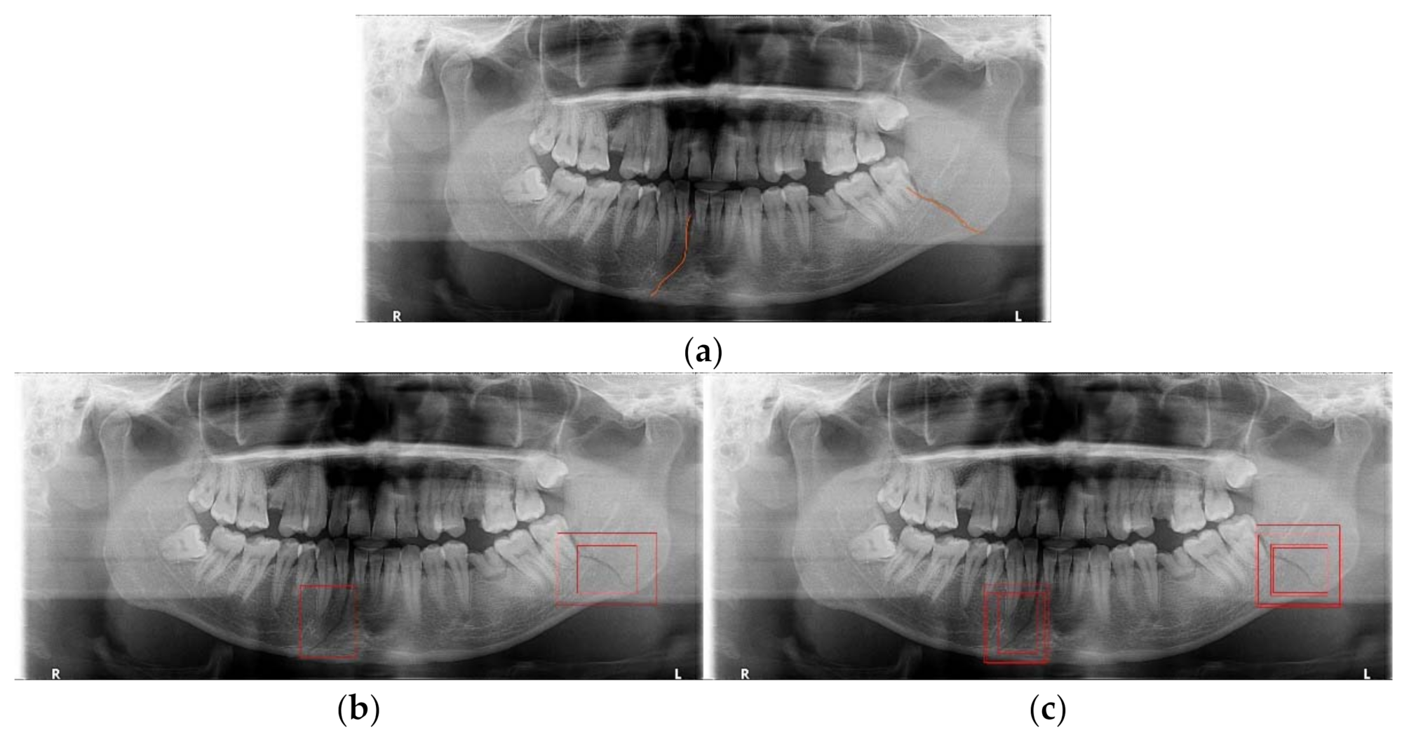 Diagnostics 11 00933 g018 Diagnostics 11 00933 g018