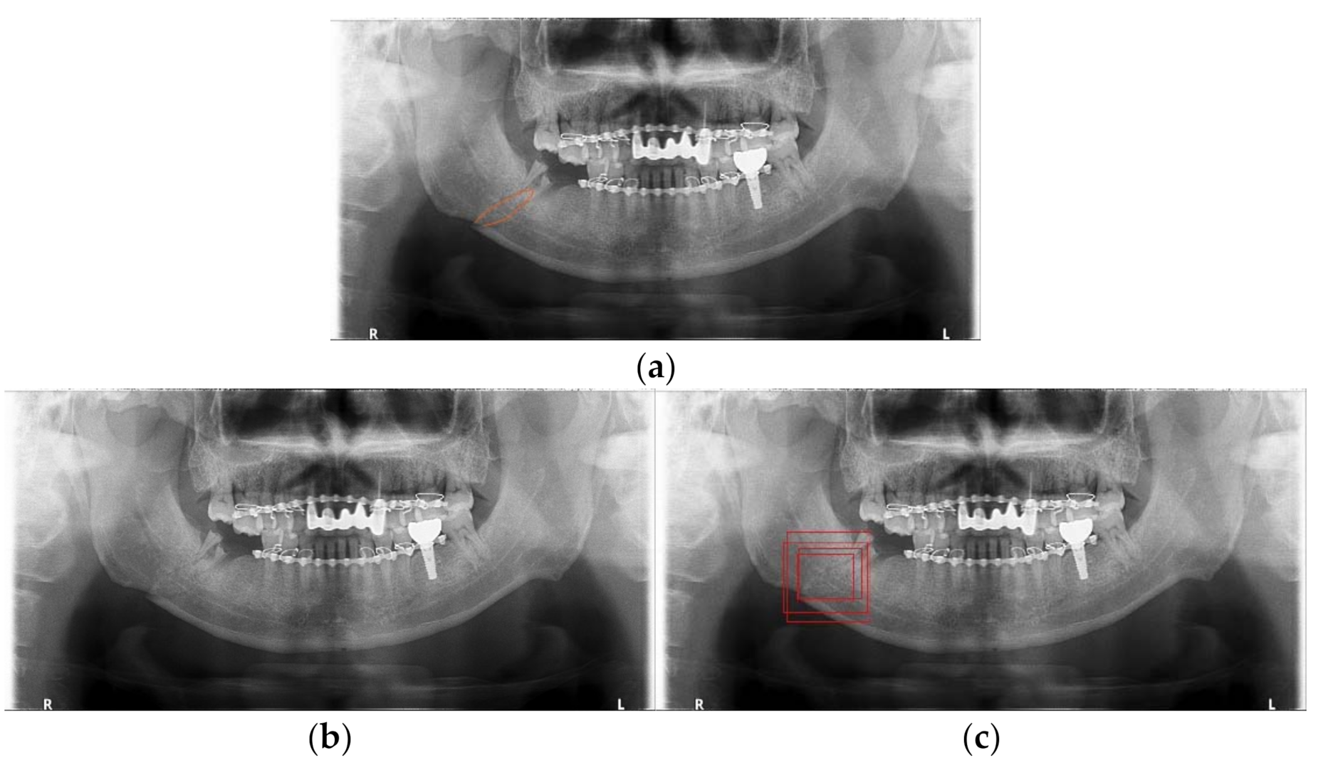 Diagnostics 11 00933 g019 Diagnostics 11 00933 g019