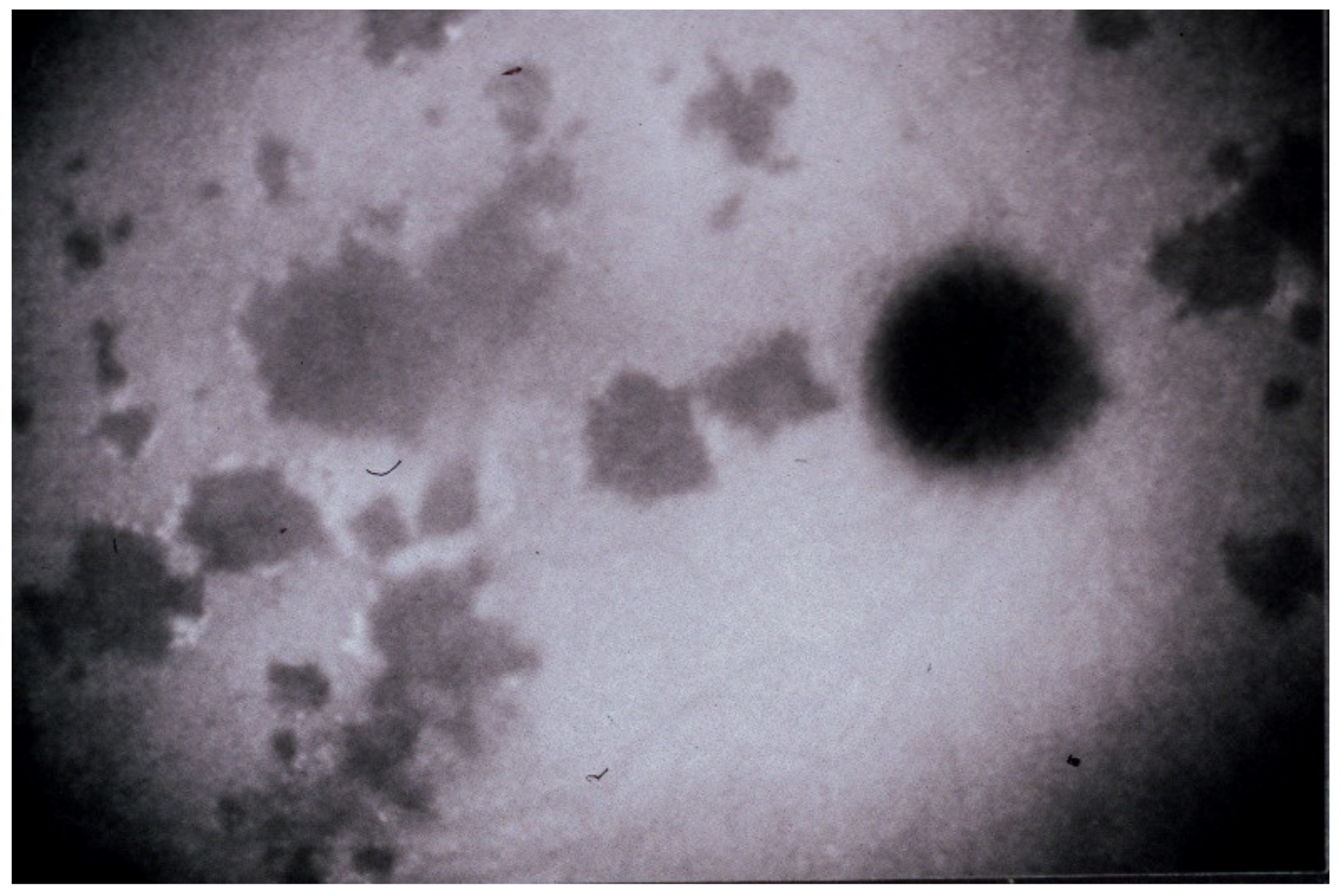 Diagnostics 11 00939 g004