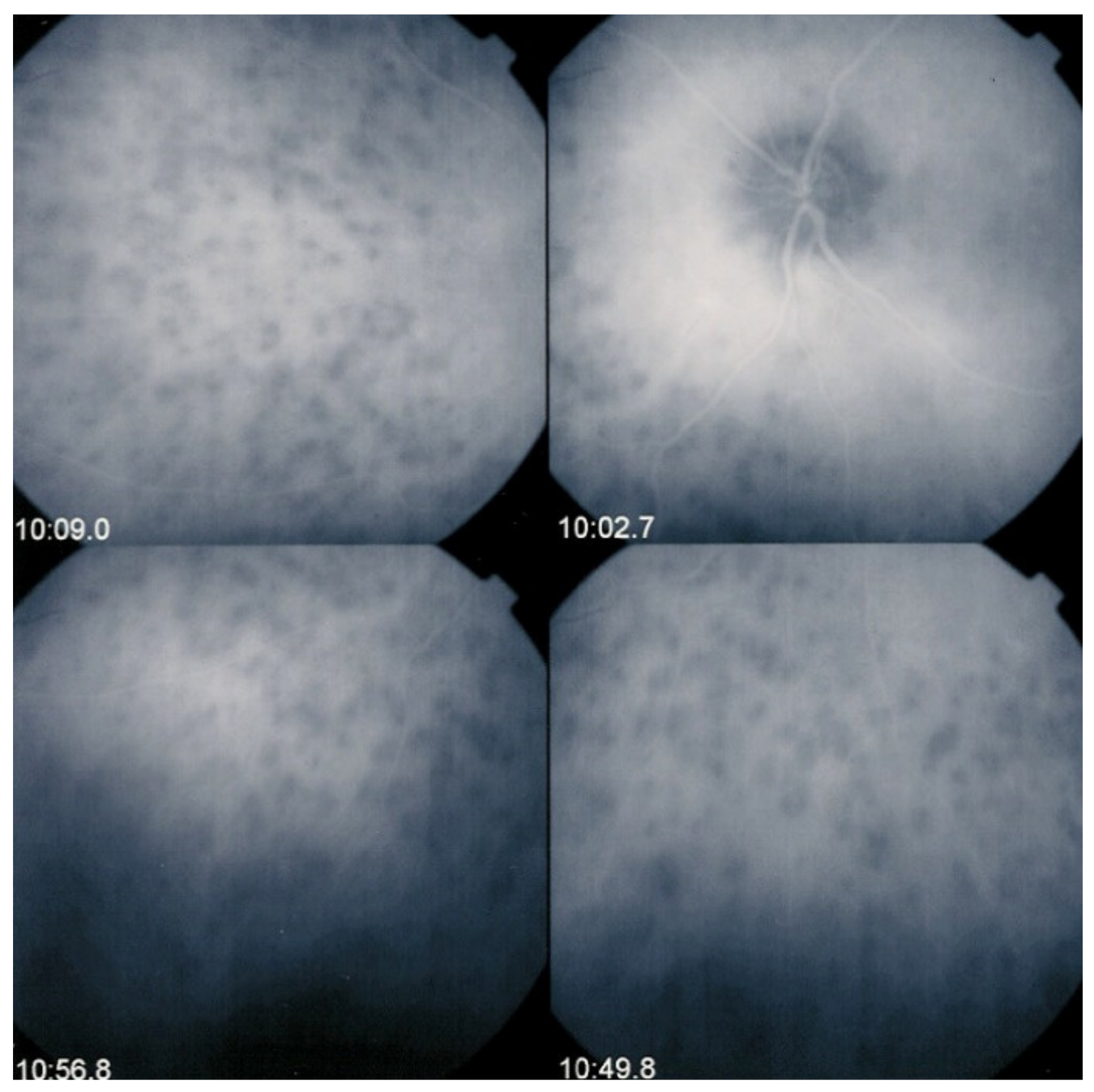 Diagnostics 11 00939 g005