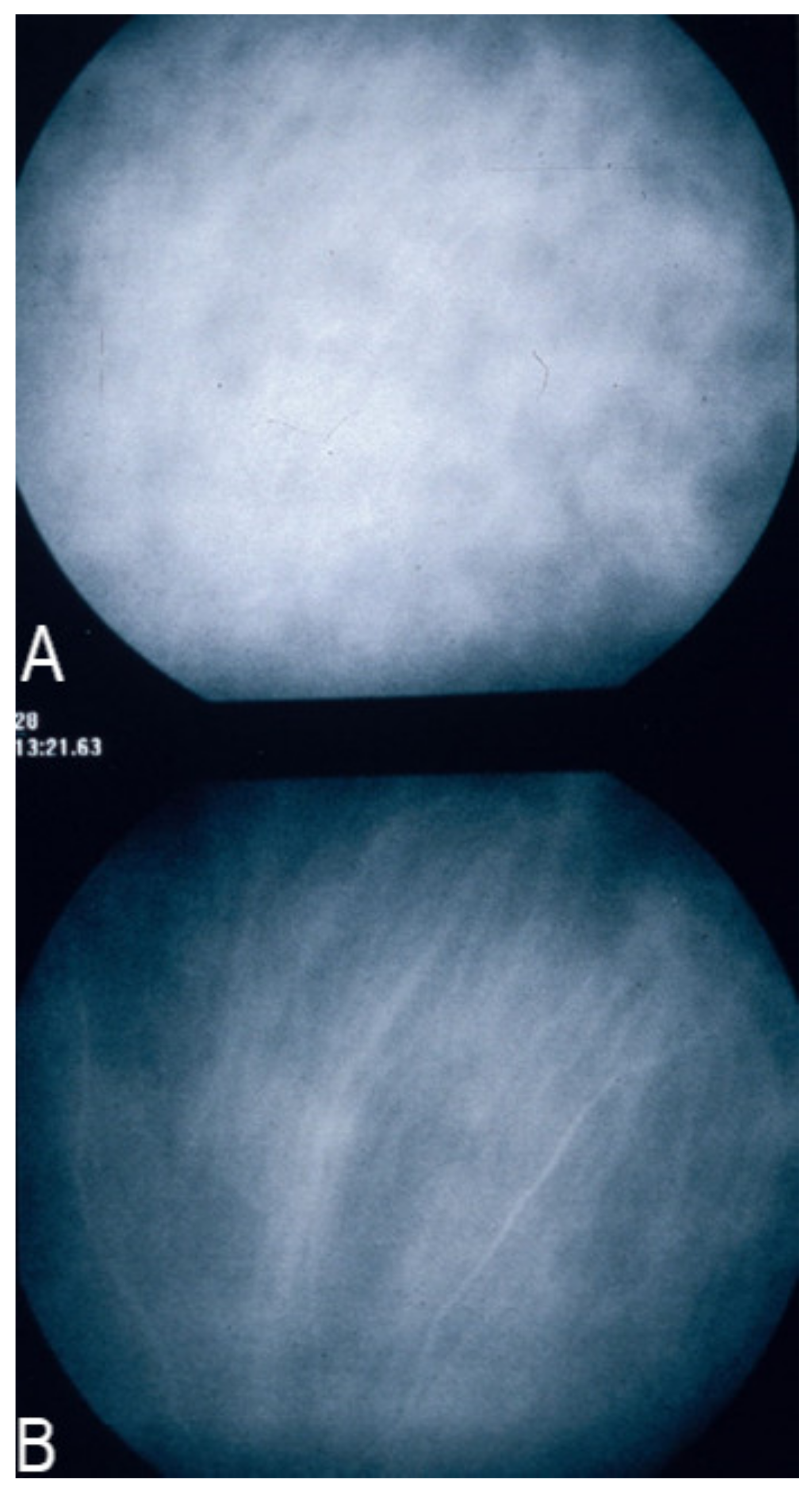 Diagnostics 11 00939 g006