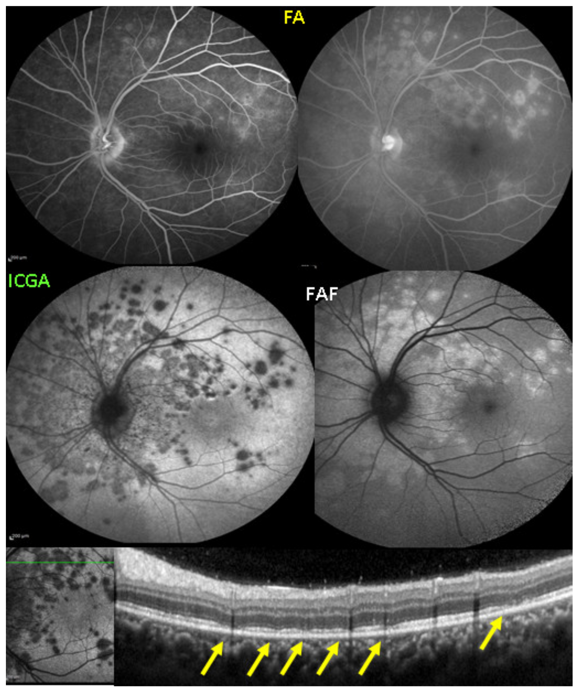Diagnostics 11 00939 g008