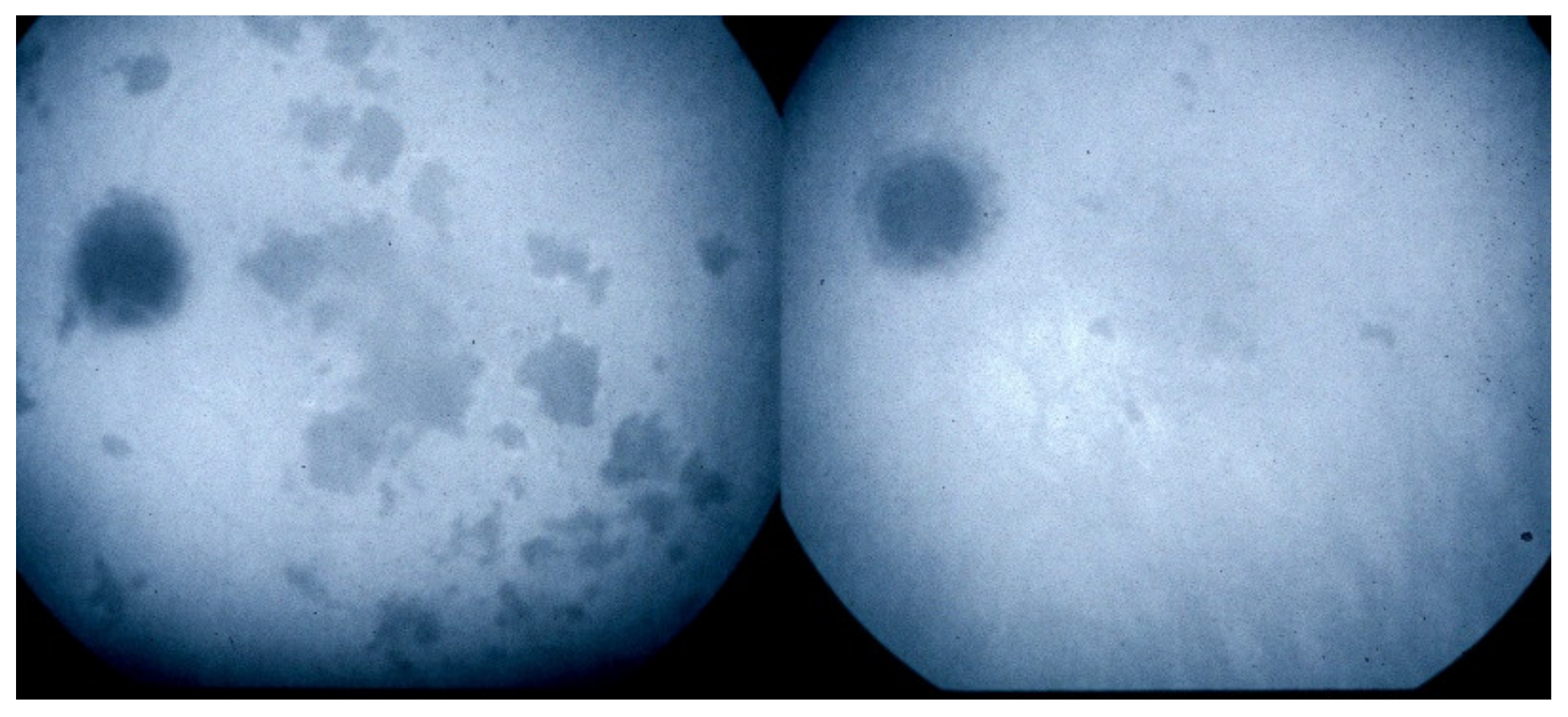 Diagnostics 11 00939 g010