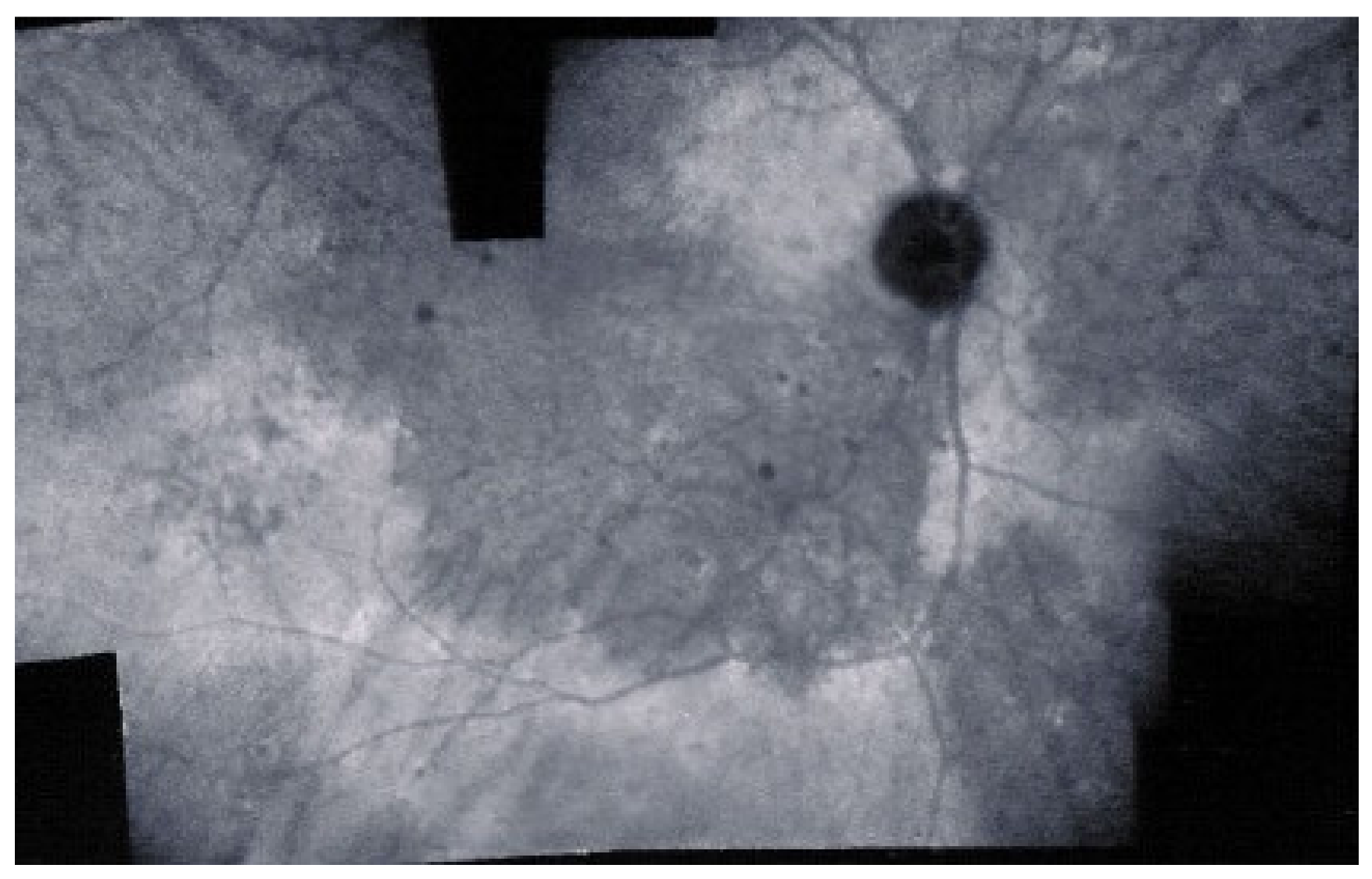 Diagnostics 11 00939 g015