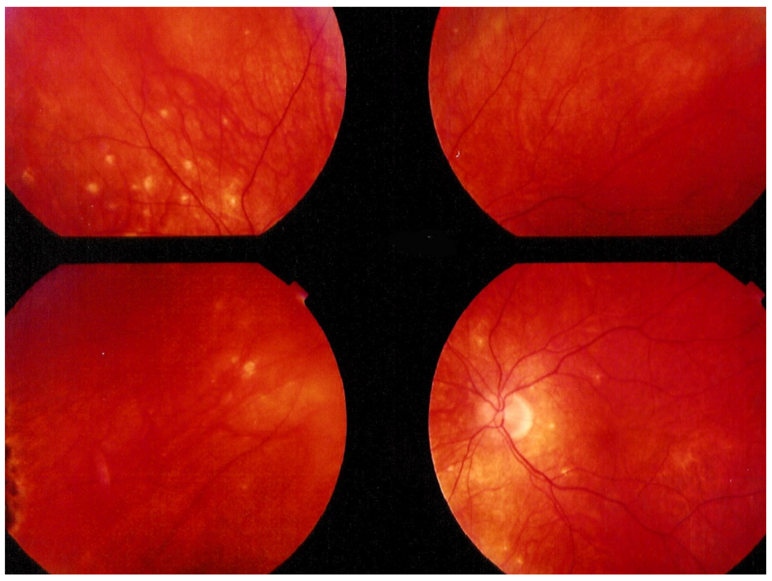 Diagnostics 11 00939 g018