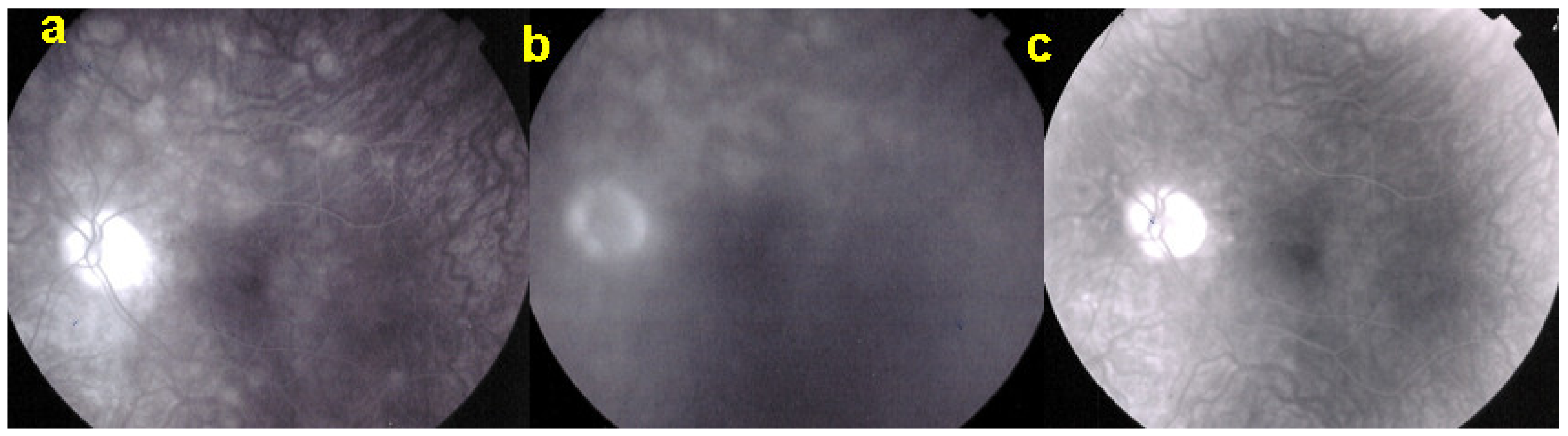 Diagnostics 11 00939 g019