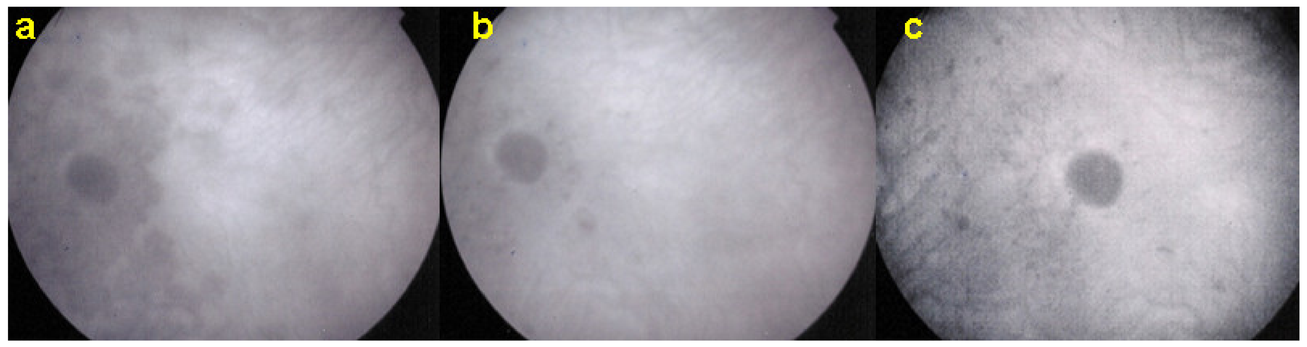 Diagnostics 11 00939 g020