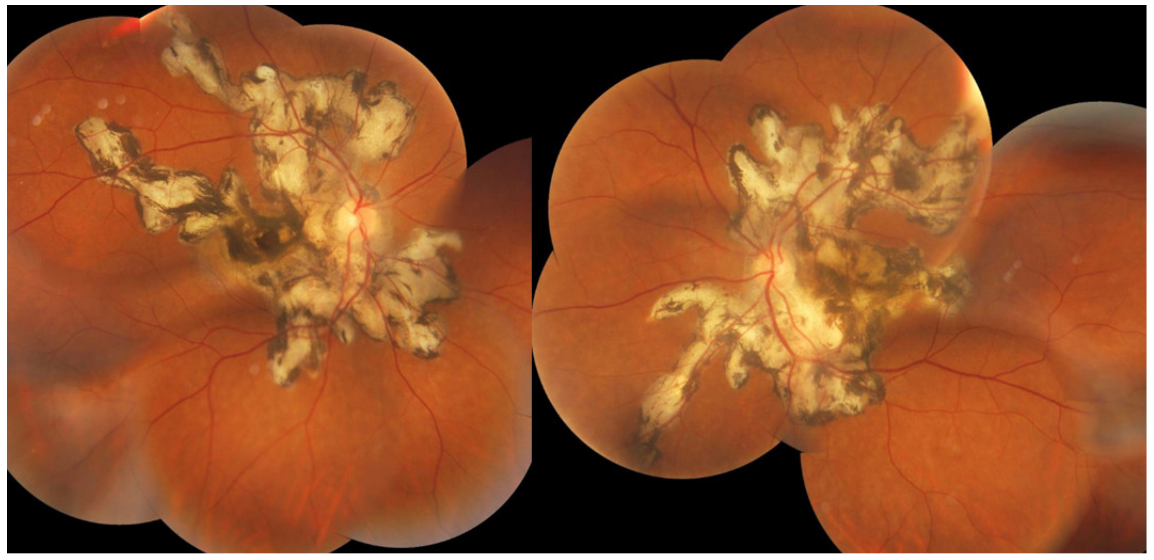 Diagnostics 11 00939 g023