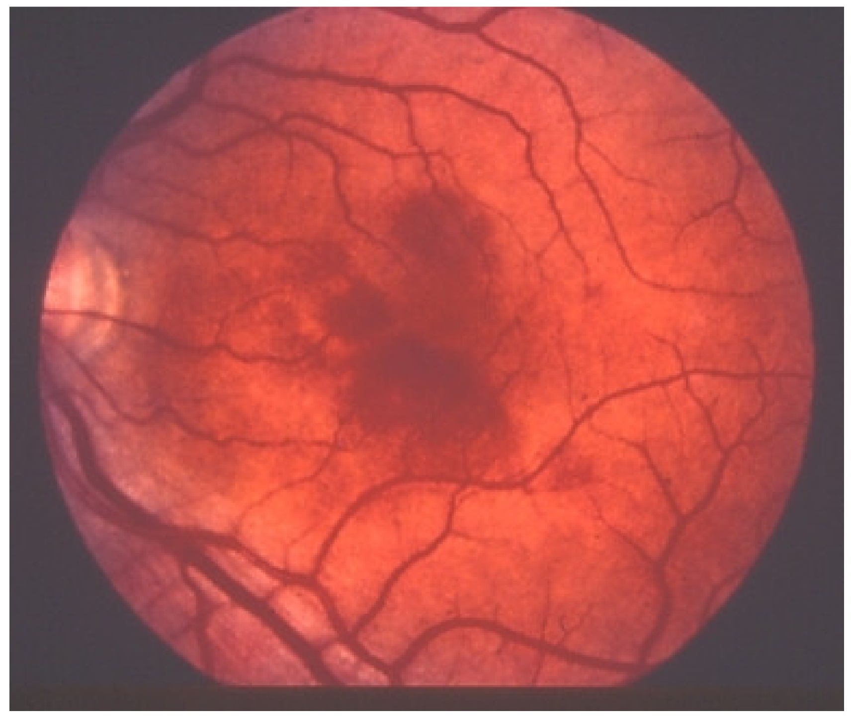 Diagnostics 11 00939 g029