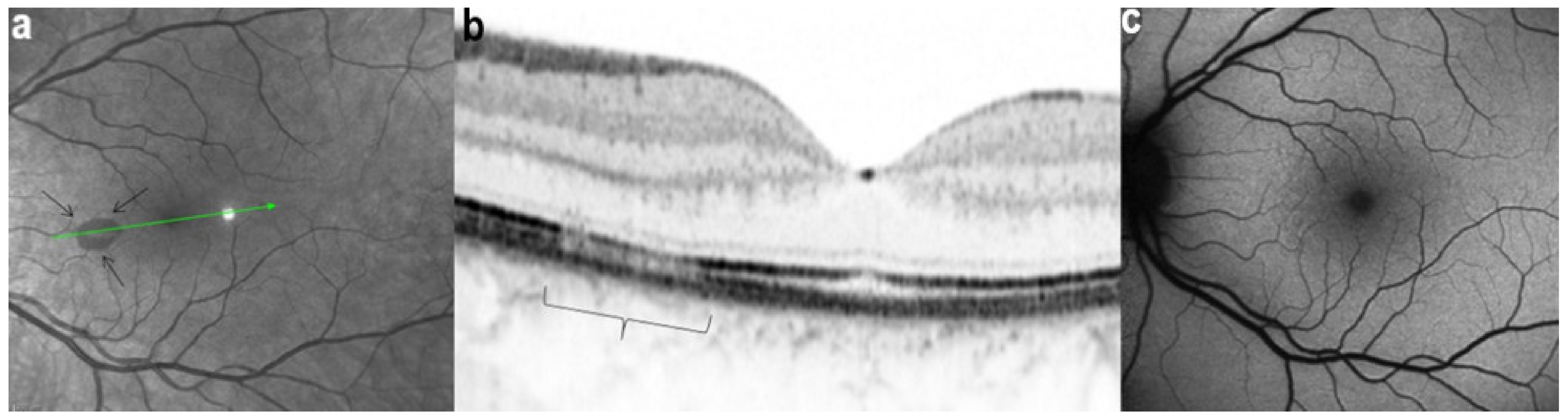 Diagnostics 11 00939 g031