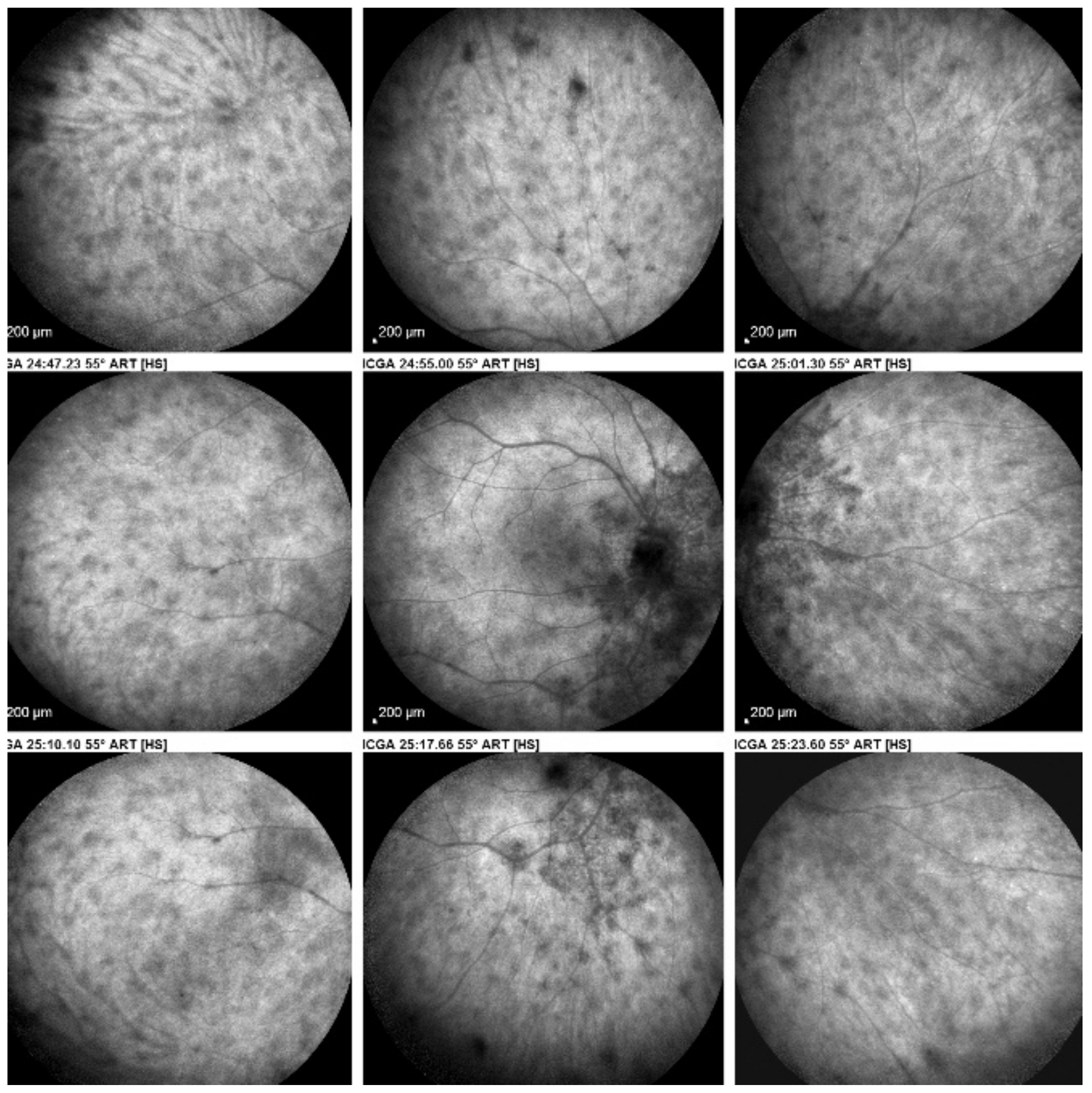 Diagnostics 11 00939 g041