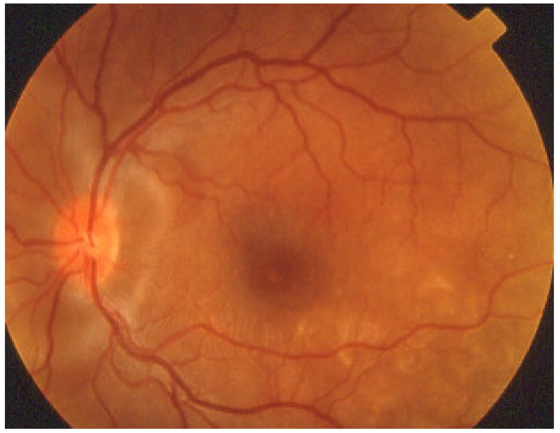 Diagnostics 11 00939 g047