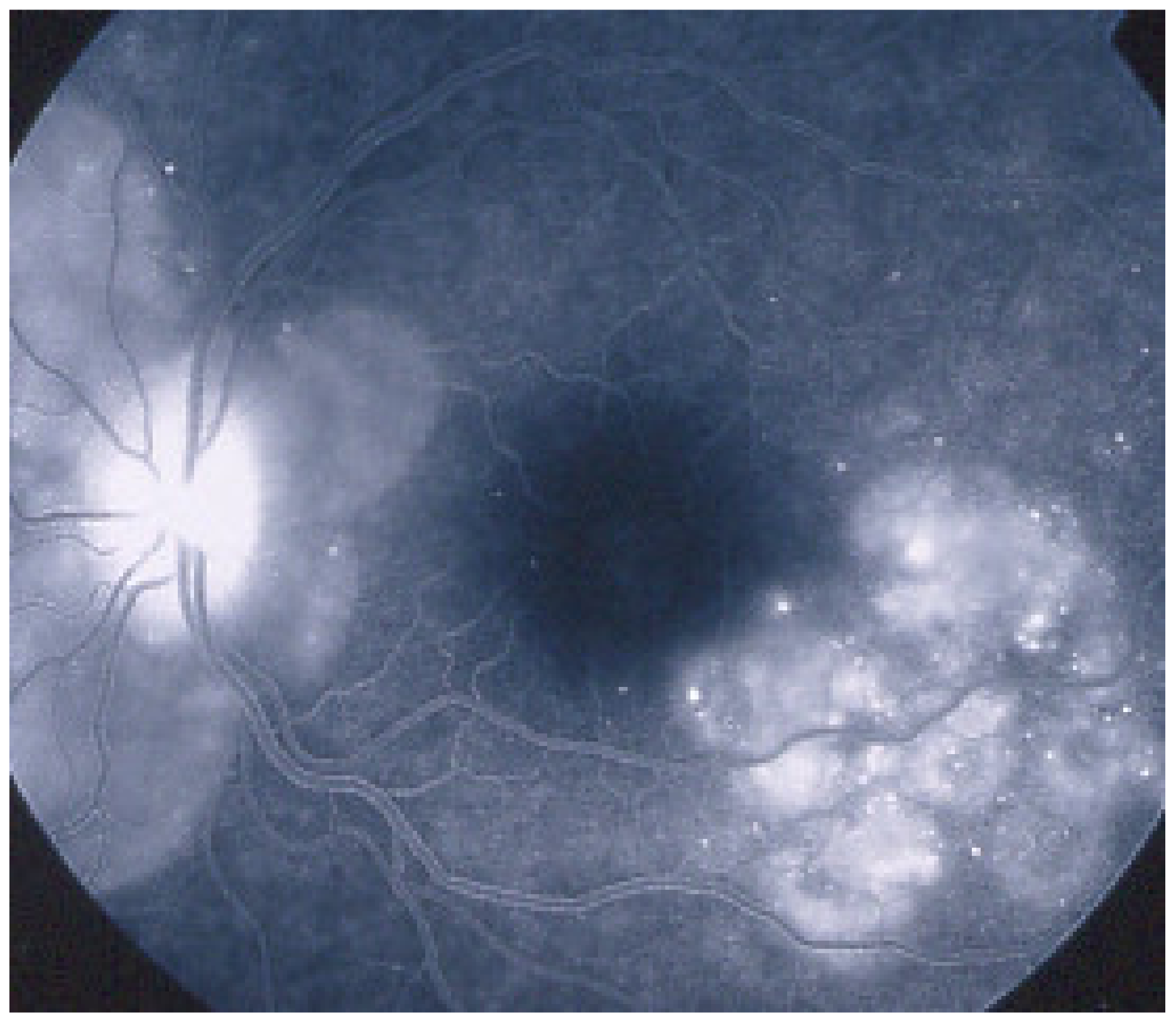 Diagnostics 11 00939 g048