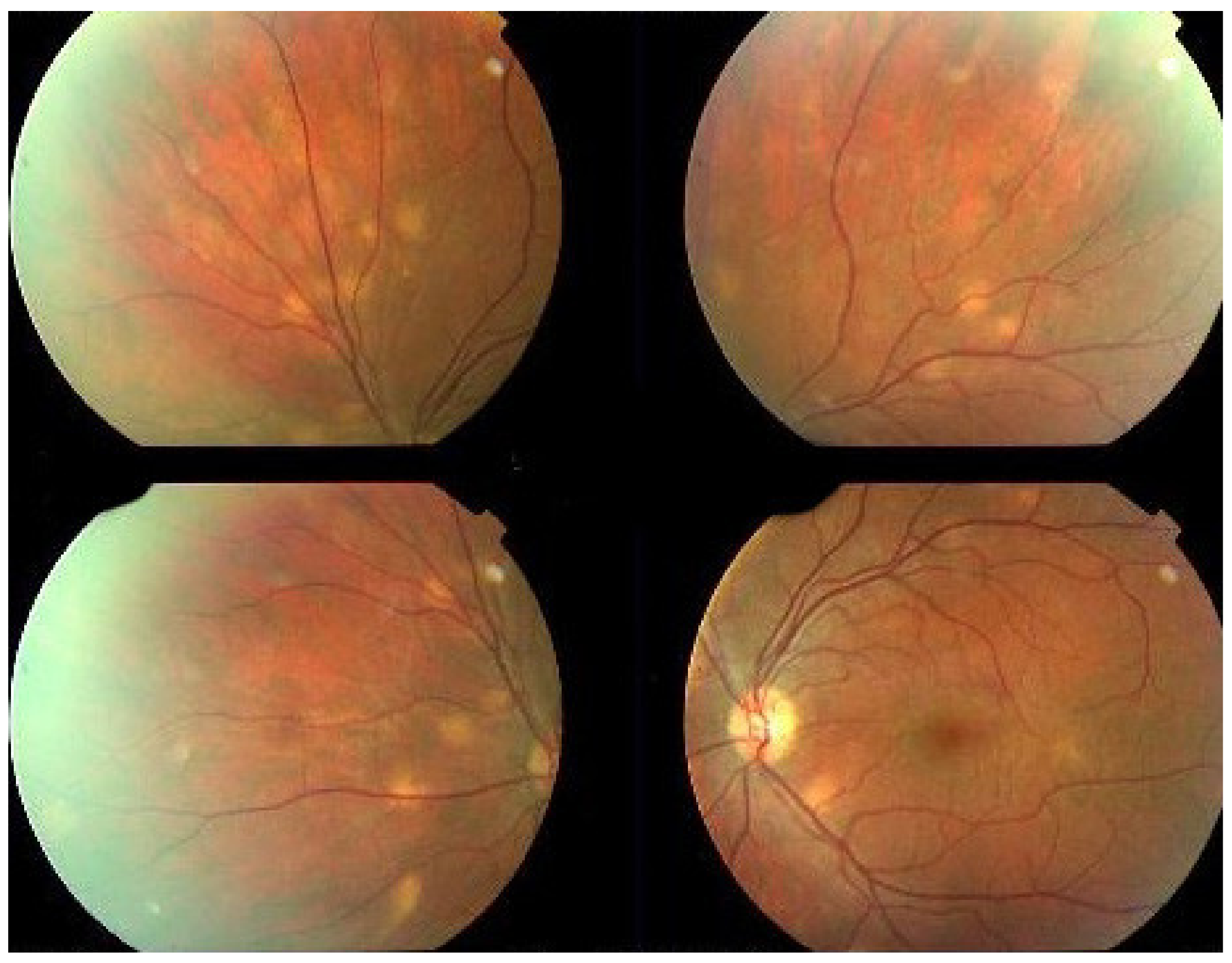 Diagnostics 11 00939 g051