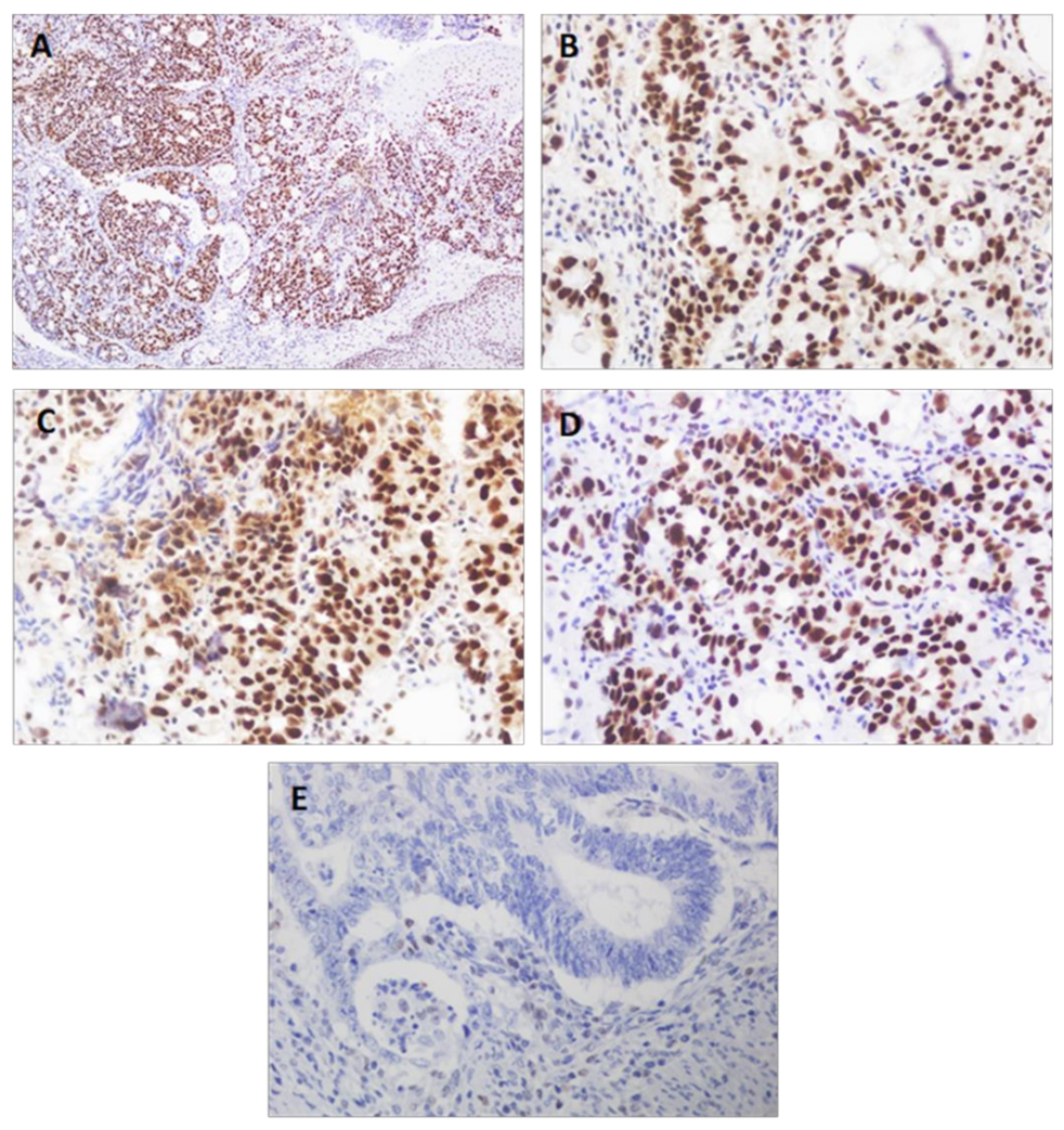 Diagnostics 11 00944 g003 Diagnostics 11 00944 g003