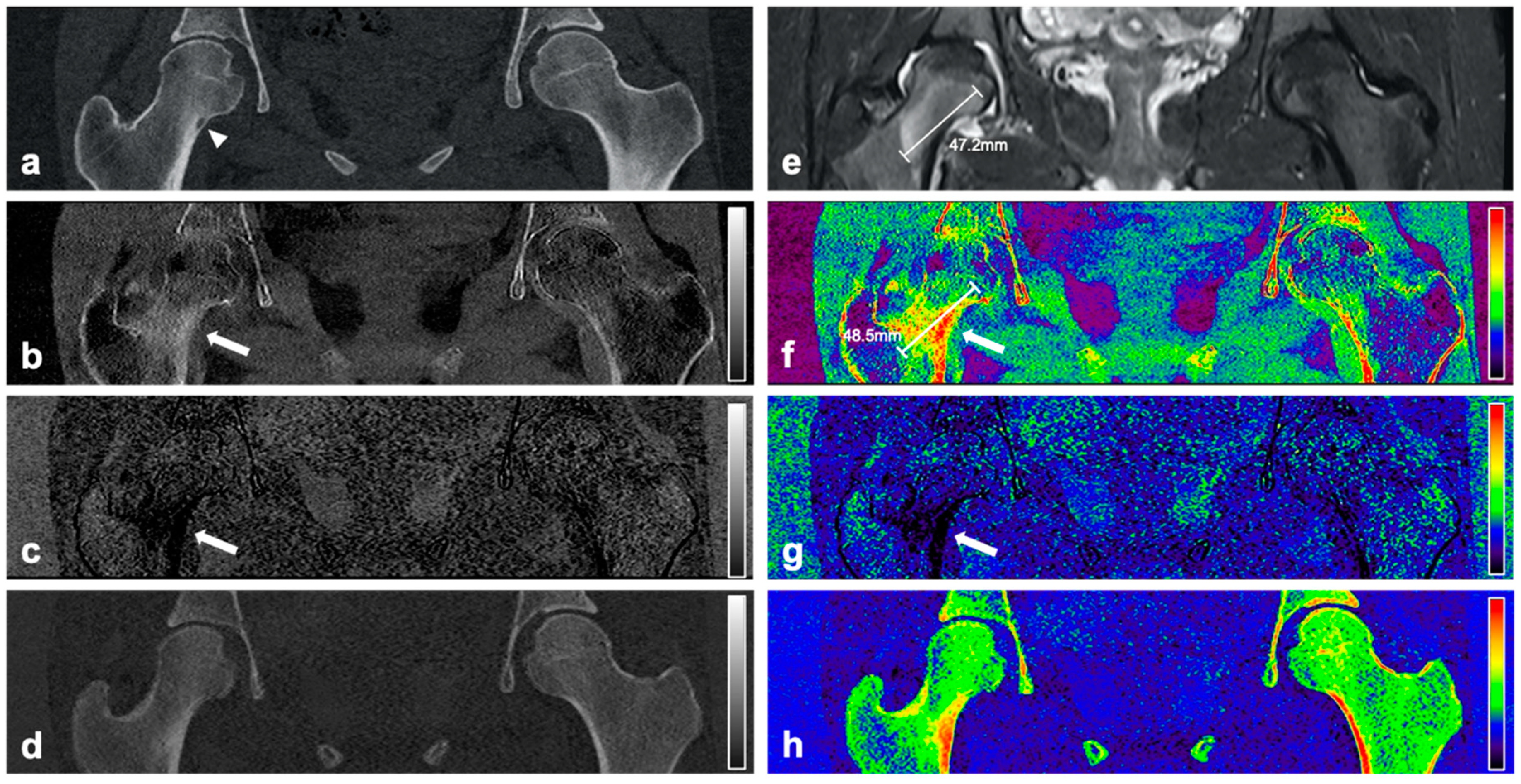 Diagnostics 11 00953 g002