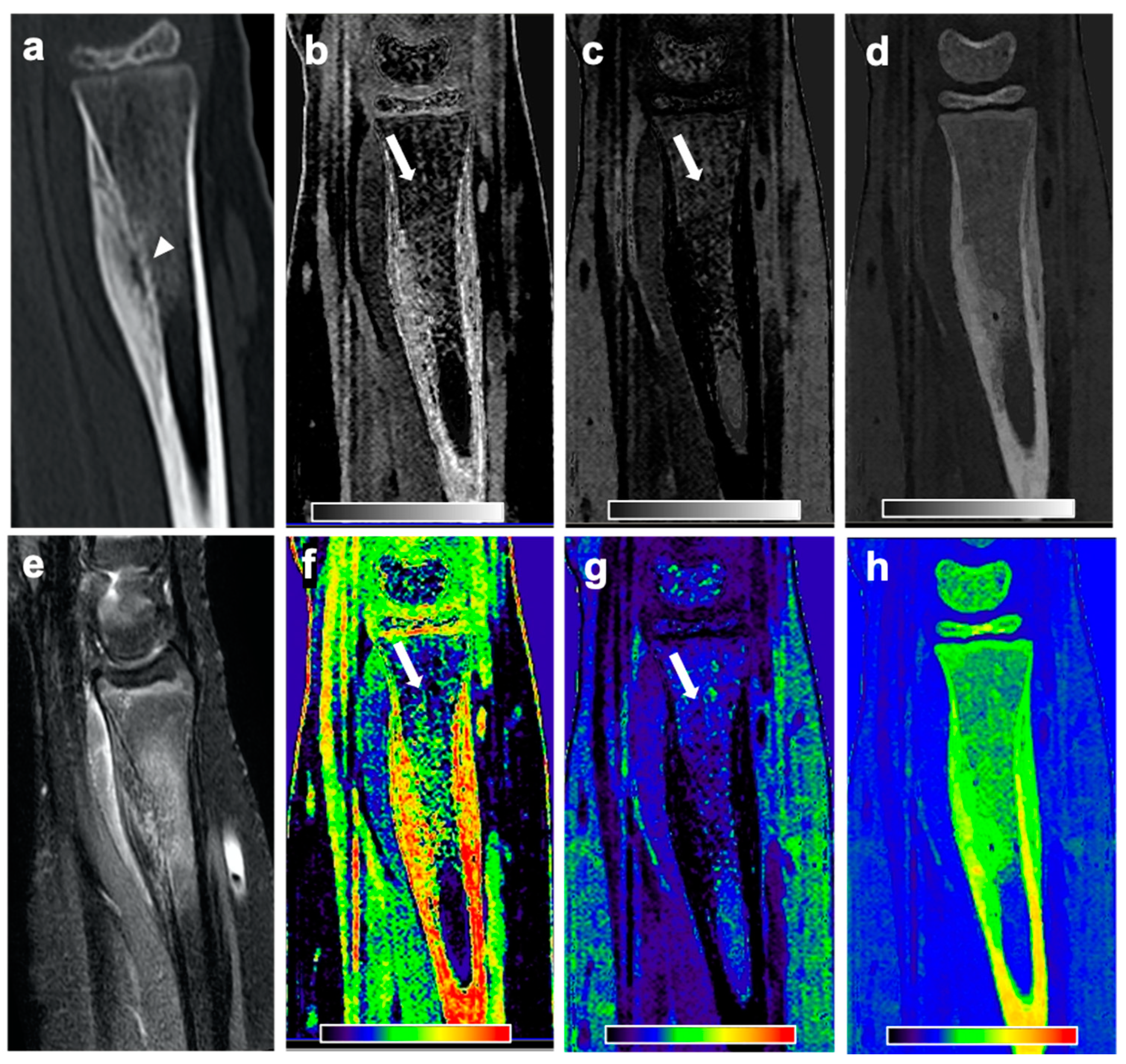 Diagnostics 11 00953 g003