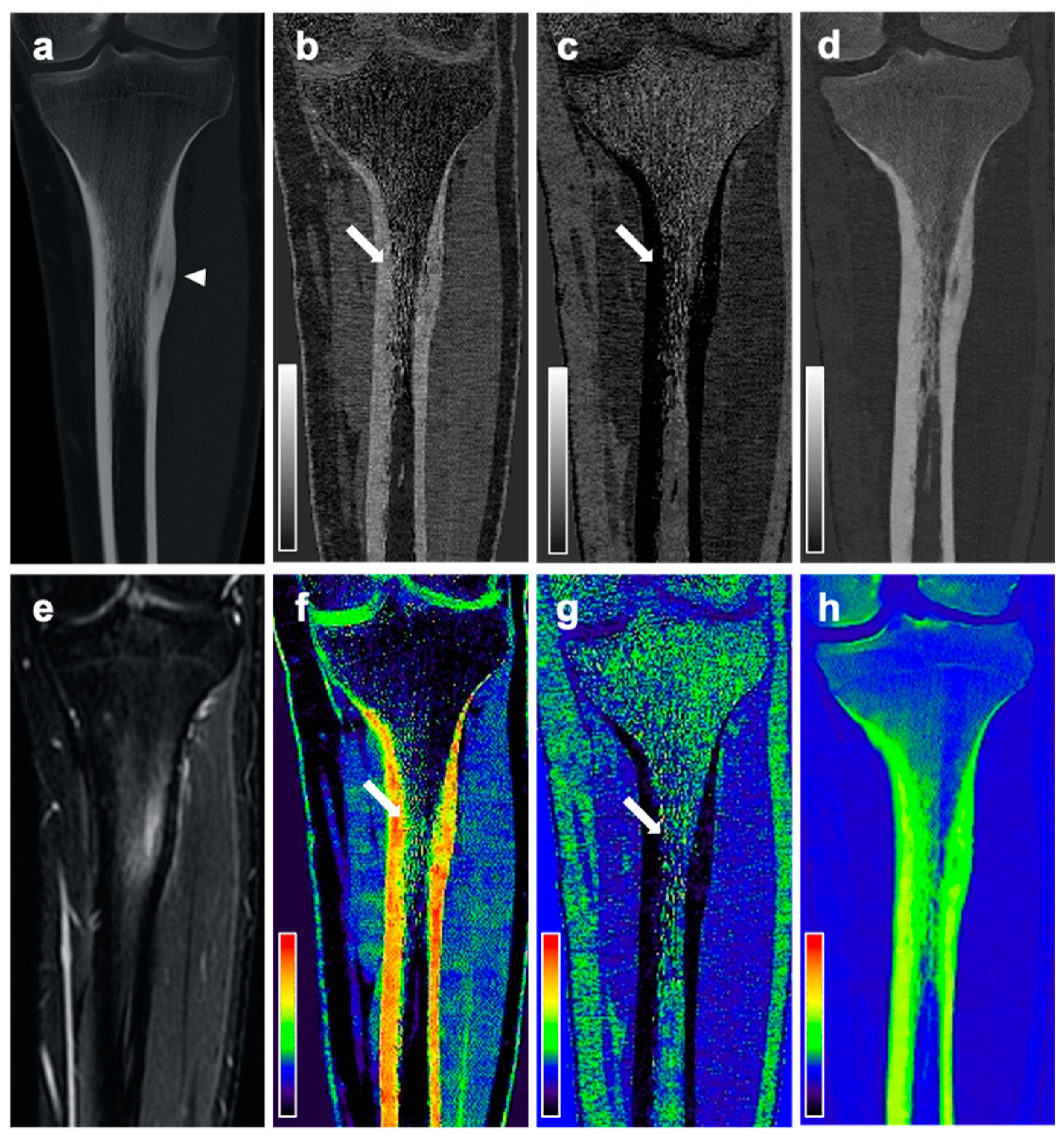Diagnostics 11 00953 g004