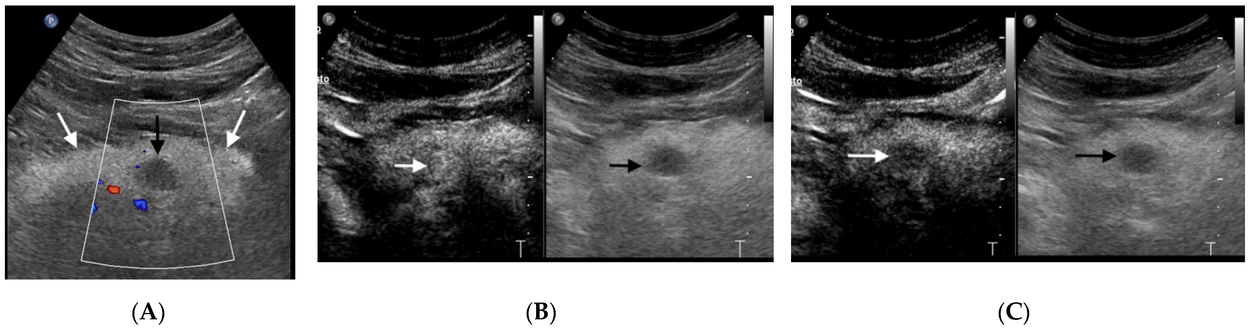 Diagnostics 11 00957 g002