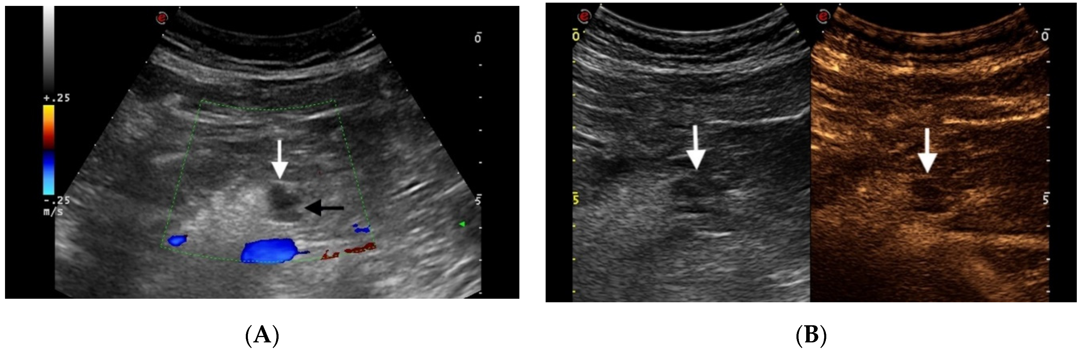 Diagnostics 11 00957 g003