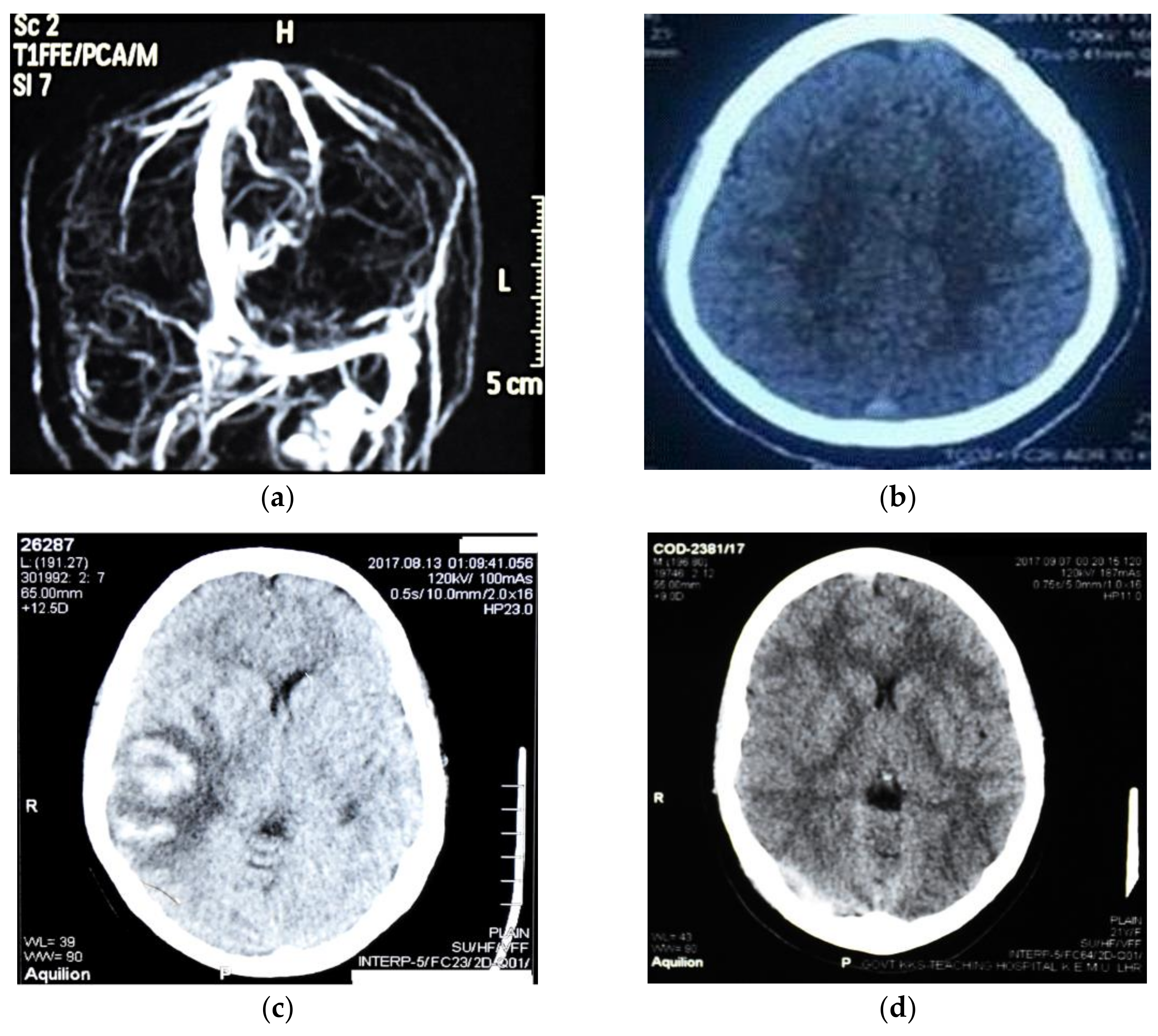 Diagnostics 11 00958 g001