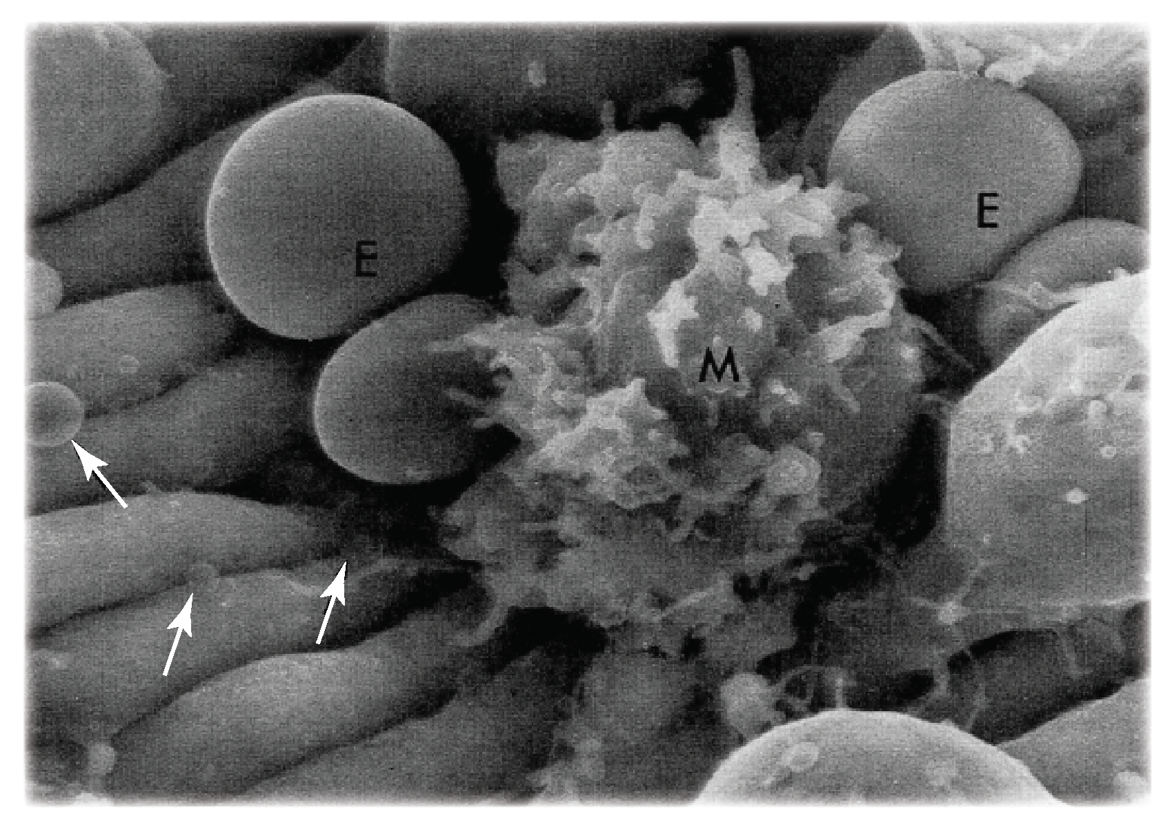 Diagnostics 11 00971 g002 Diagnostics 11 00971 g002