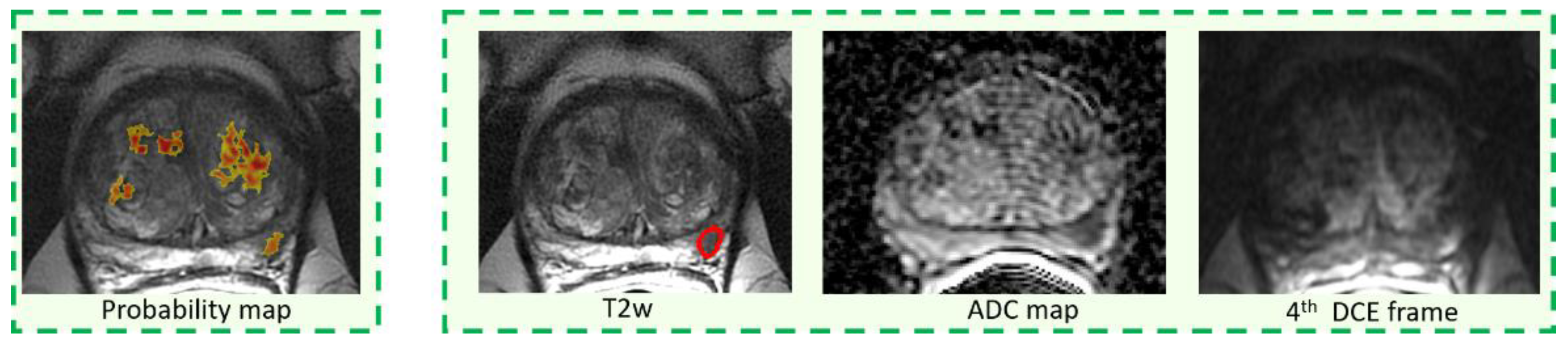 Diagnostics 11 00973 g004 Diagnostics 11 00973 g004