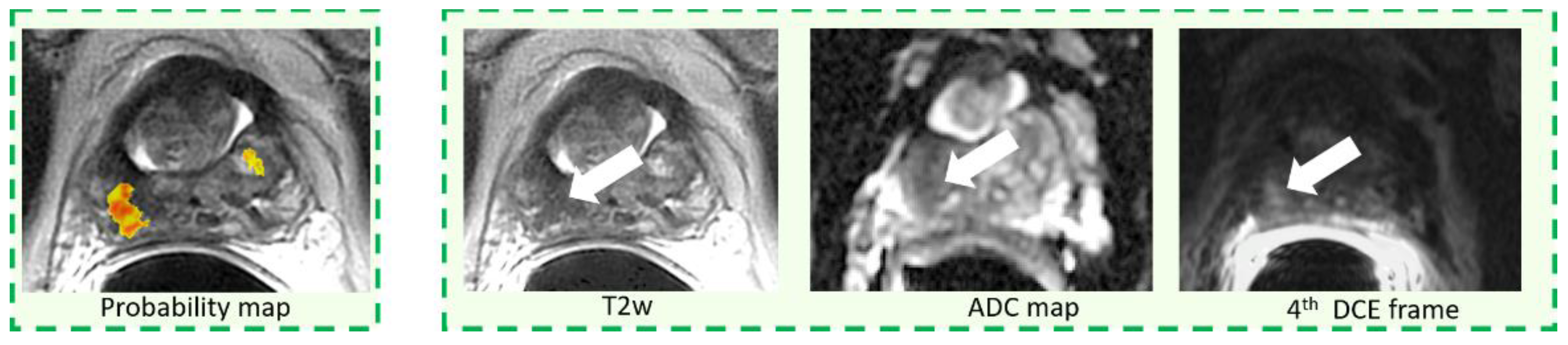 Diagnostics 11 00973 g005 Diagnostics 11 00973 g005